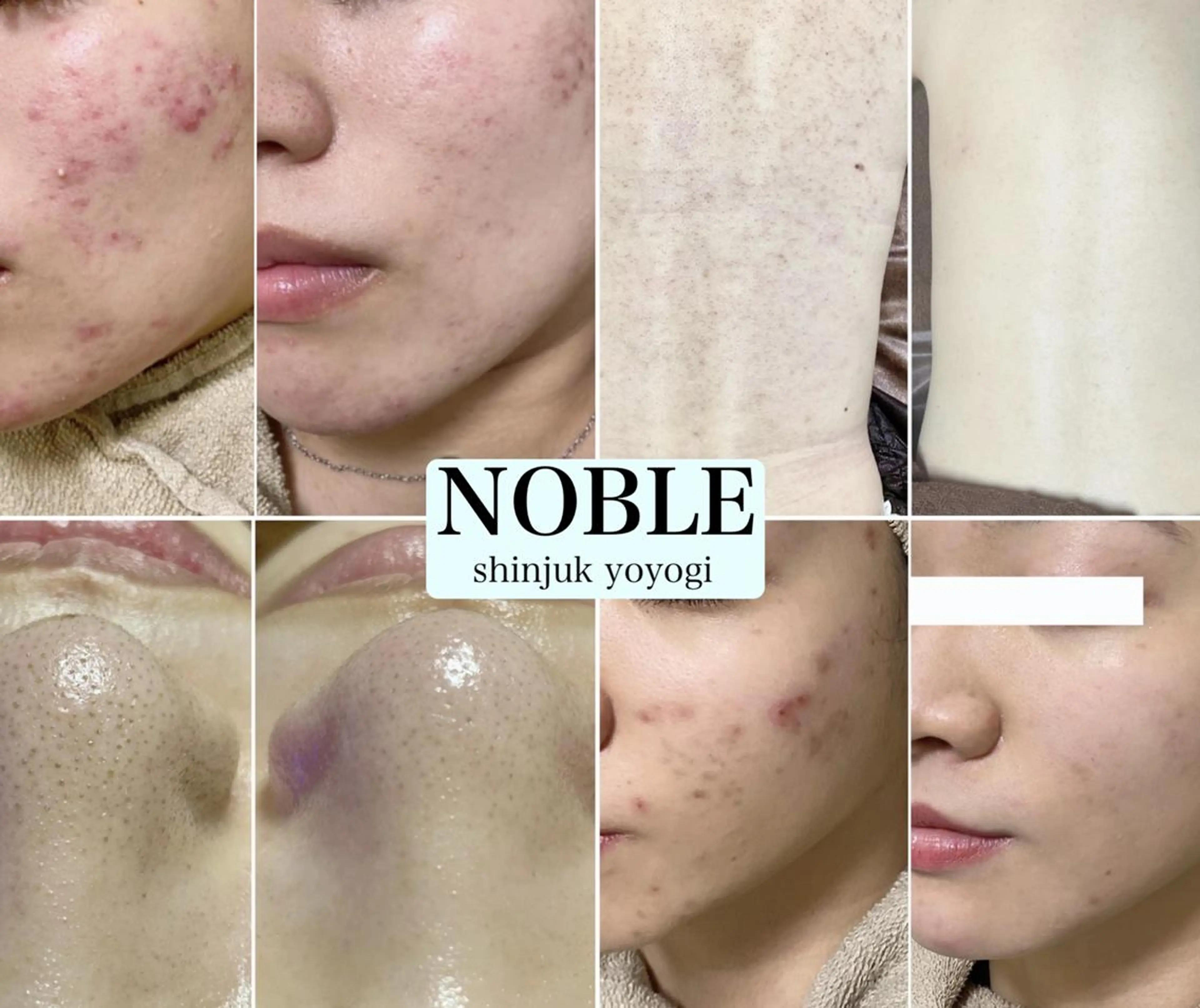 NOBLE 新宿南口店のエステ・リラクイメージ