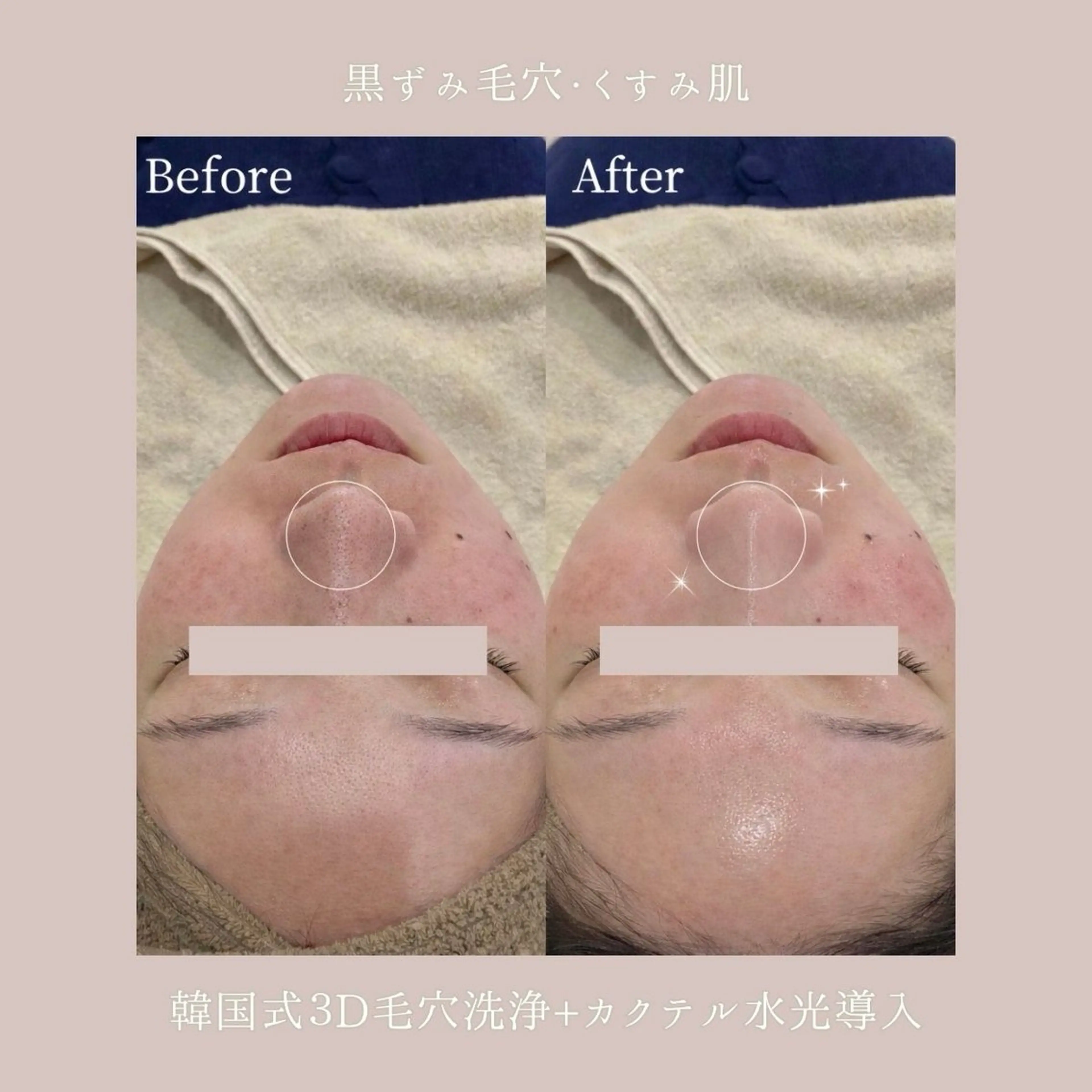 エステ Lyséa新宿 ♡kaoriのエステ・リラクイメージ