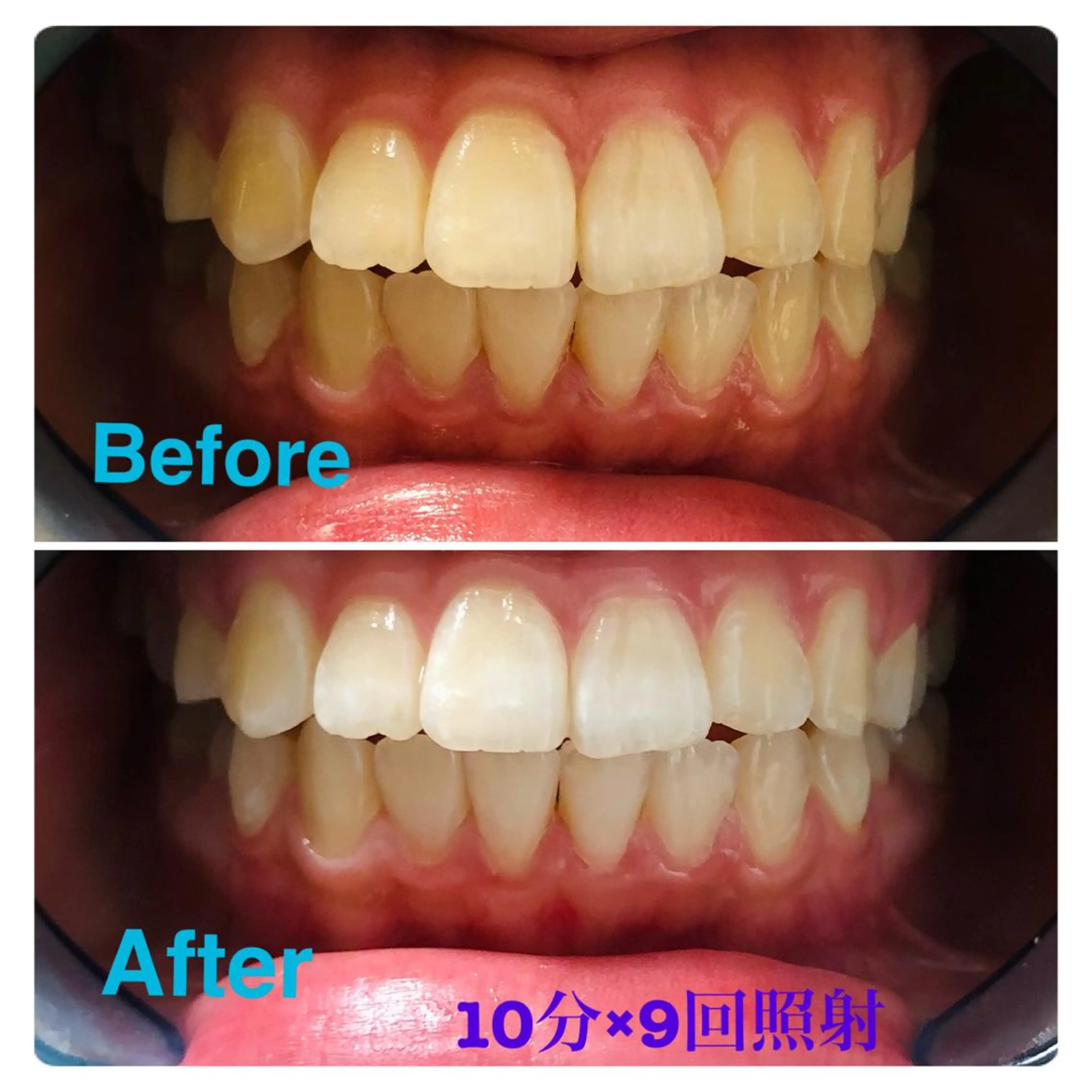 イーチブライト EachBrightのその他イメージ