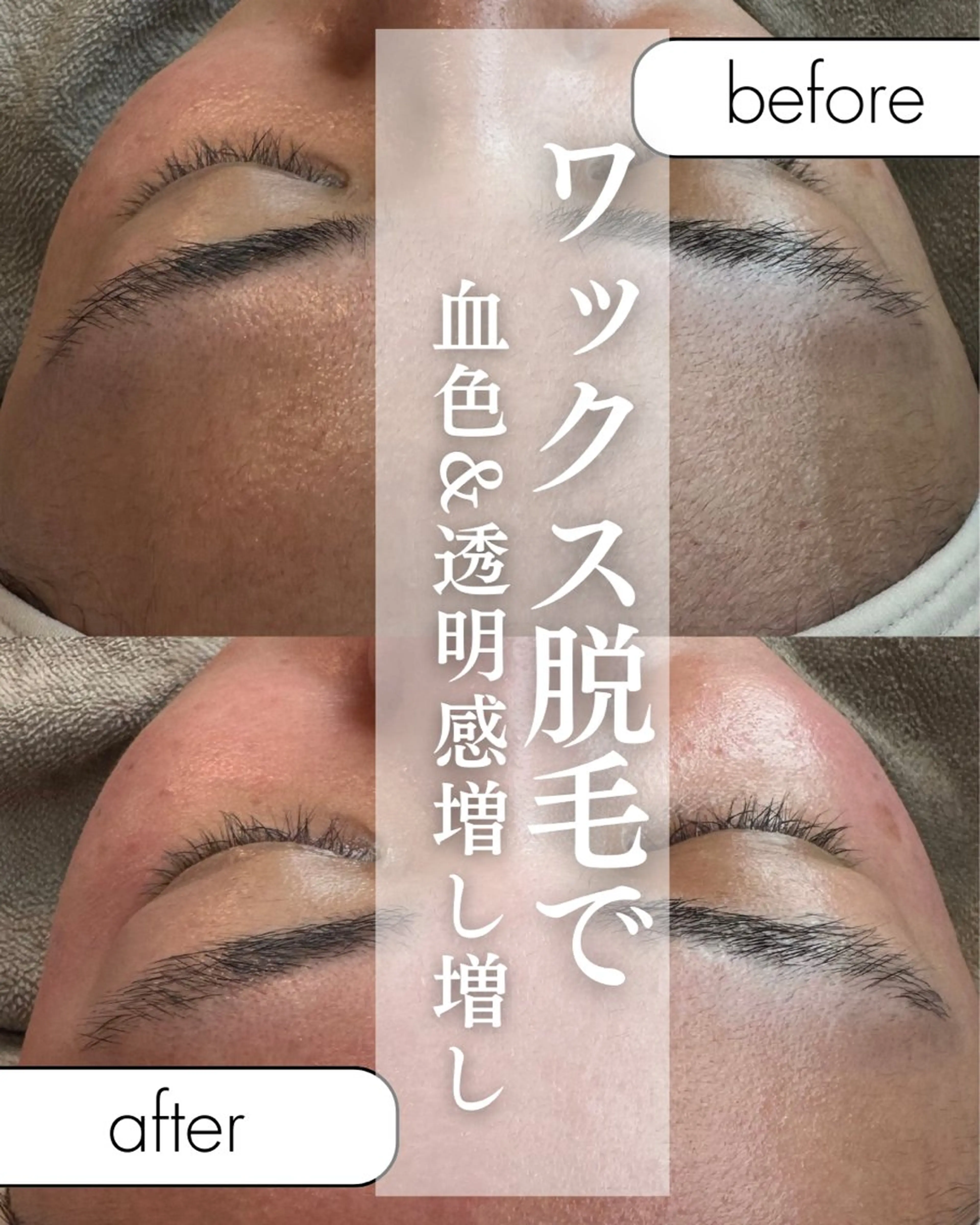 una salon / ネイル&顔脱毛のネイルデザイン