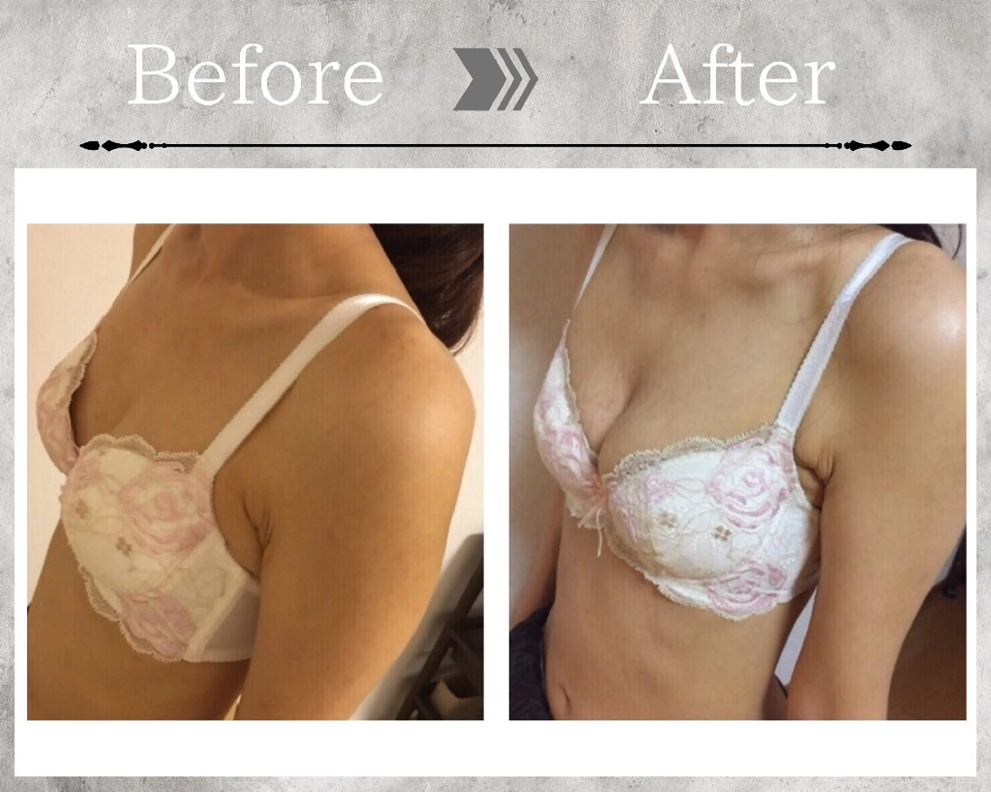 その他 【バストケアサロン】 Feliz フェリスのエステ・リラクイメージ