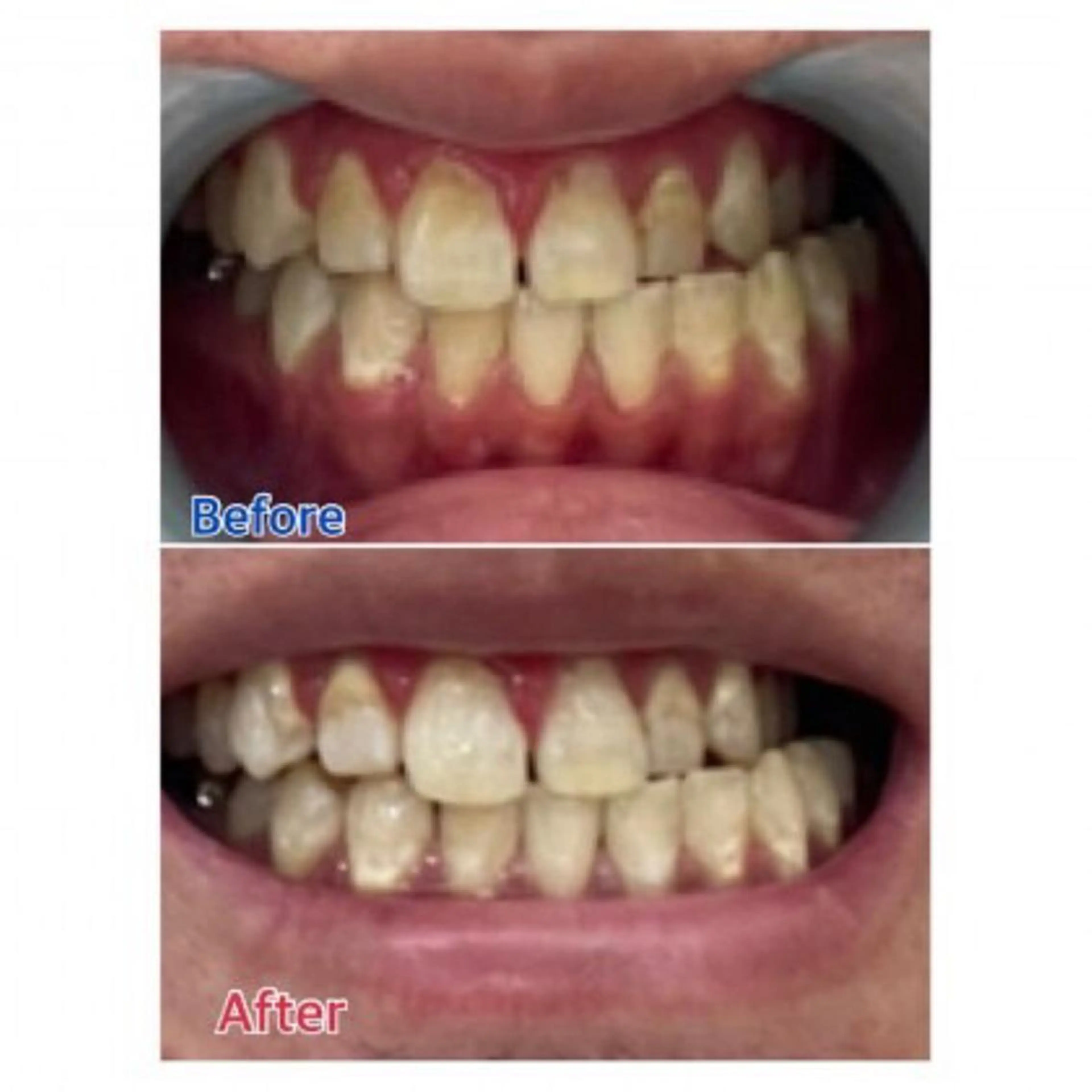 Ｍ渋谷 ホワイトニングのエステ・リラクイメージ