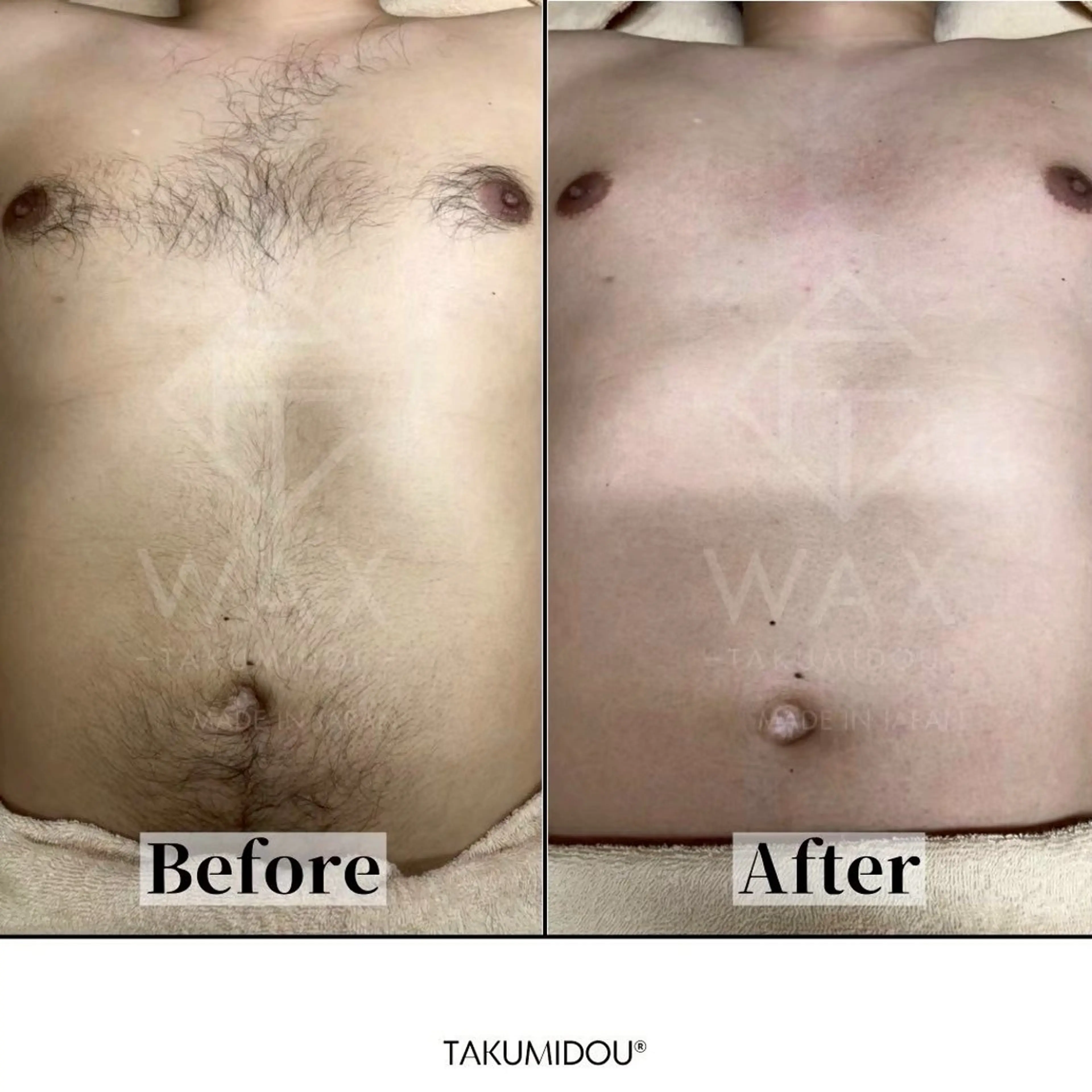 JYUNESU所属・銀座 ワックス脱毛のエステ・リラクイメージ