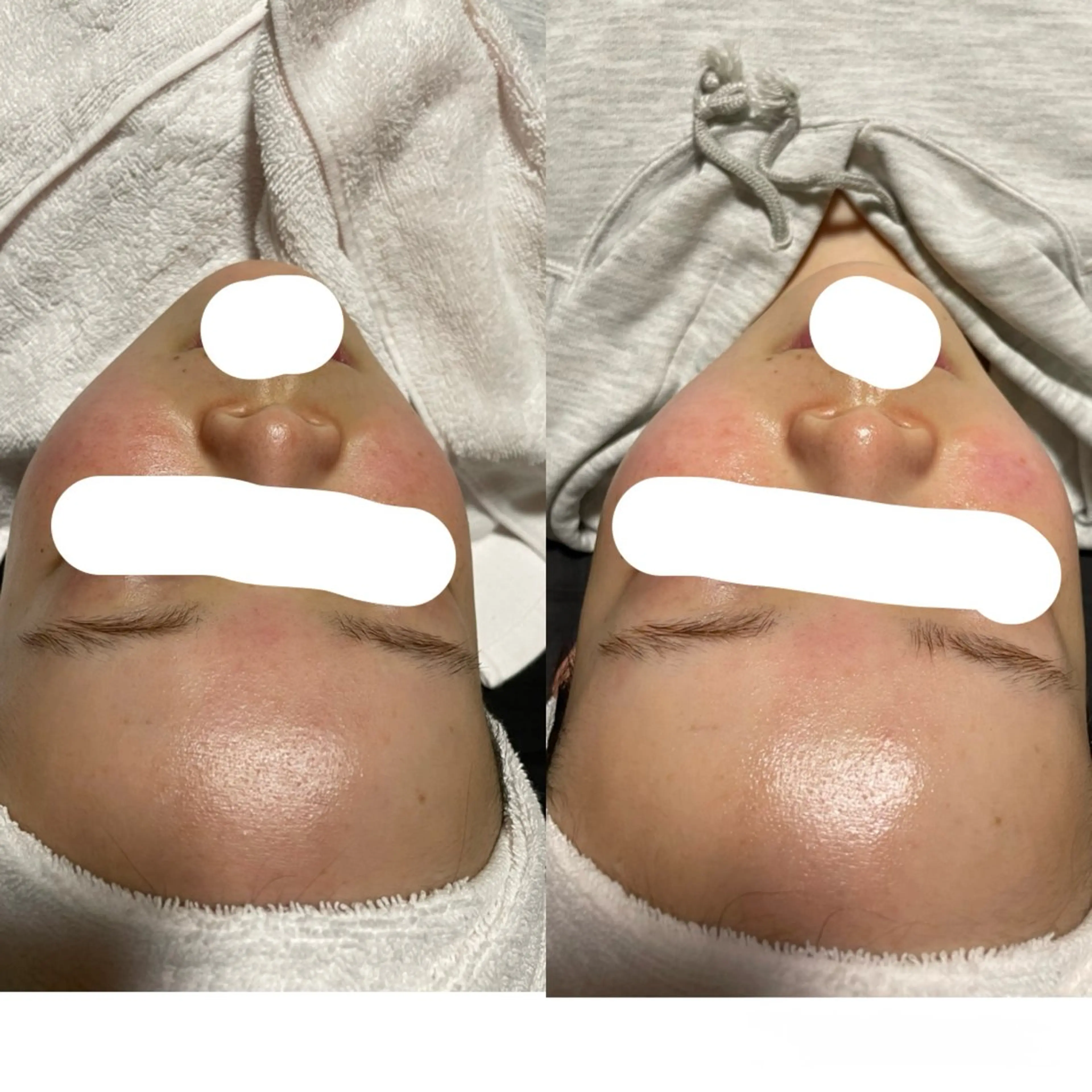 エステサロンPONO所属・PONO 天王寺／エステのエステ・リラクイメージ