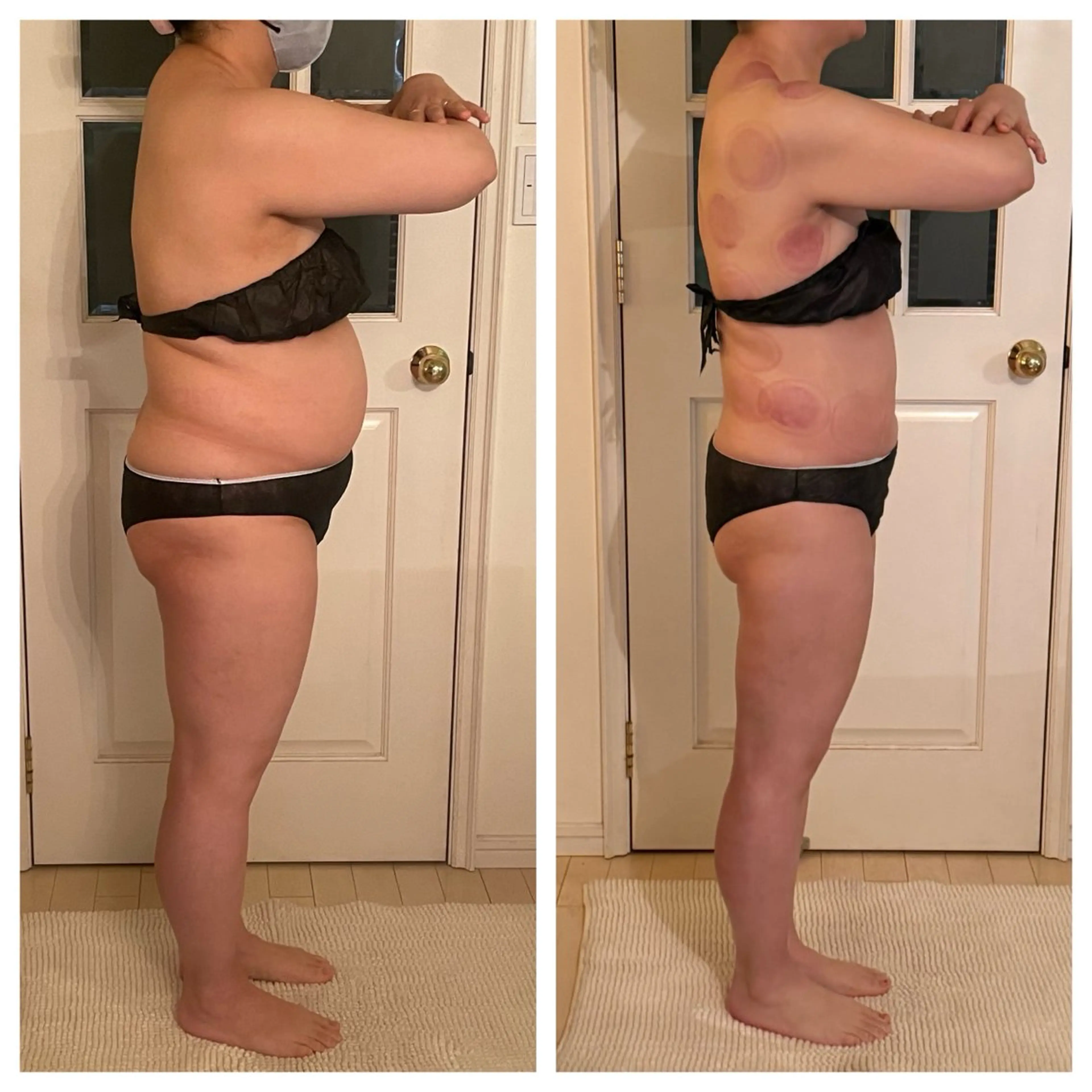 エステ リラク 超ド級痩身/ 肩こり撃退のエステ・リラクイメージ