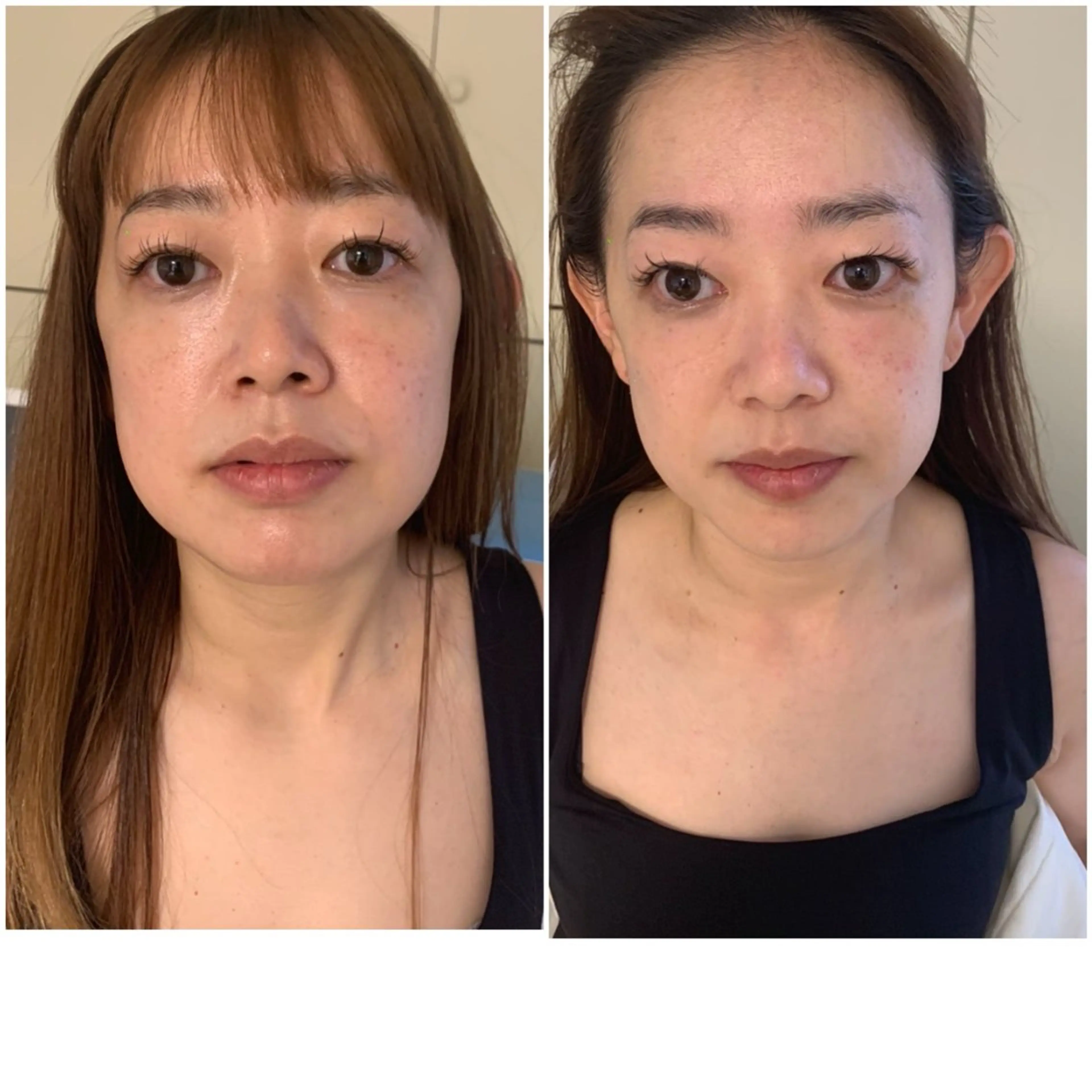 マツエク・マツパ エステ aliaハイフ&水光ジェットサロン所属・aliaハーブ水光店 エステティシャン募集のエステ・リラクイメージ