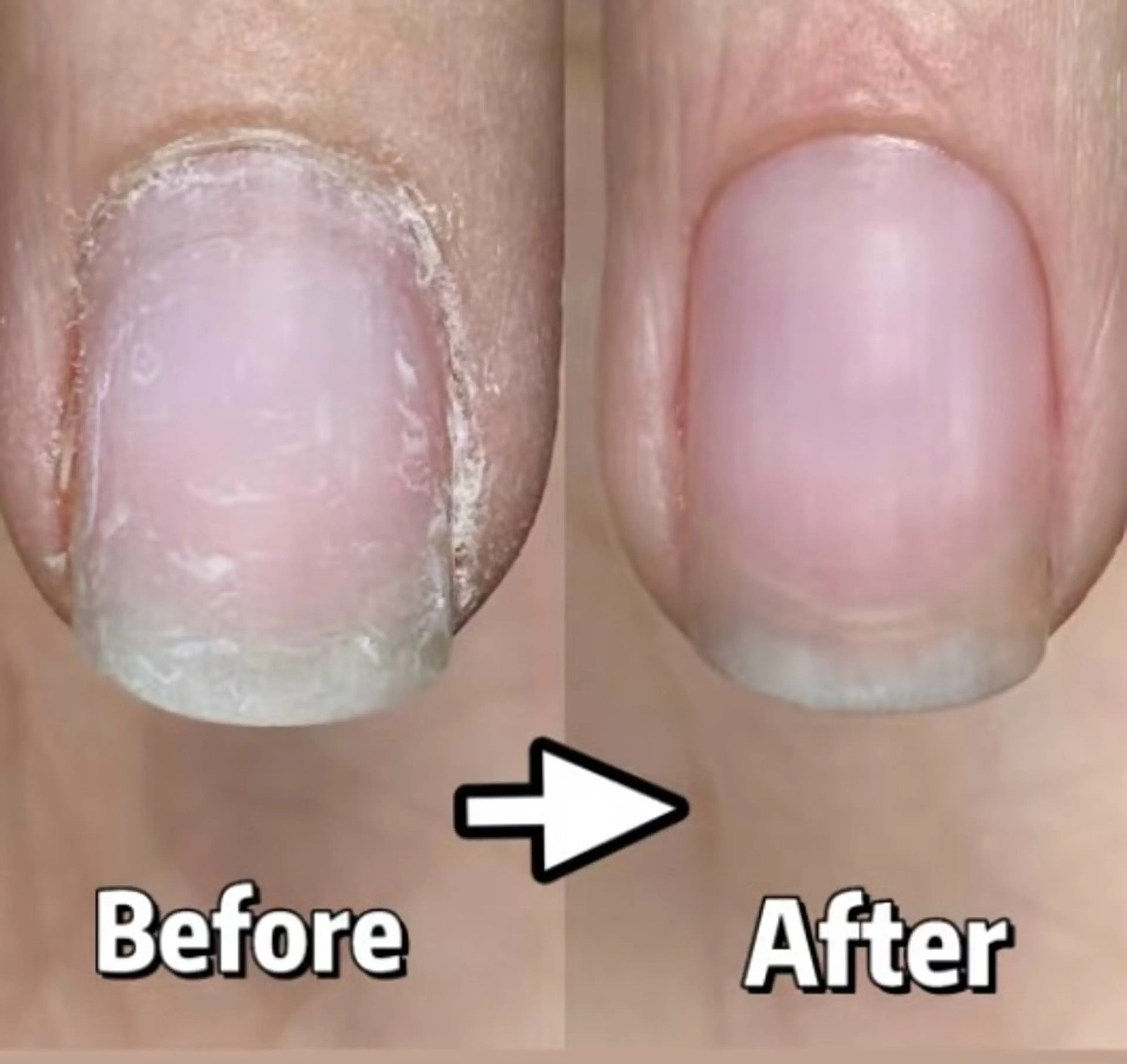 清潔感UP！ウォーターケア＋爪磨き ¥2,980爪の形整え＋甘皮ケア＋爪磨き時間：約30分📌平日15時まで／男性OKの写真