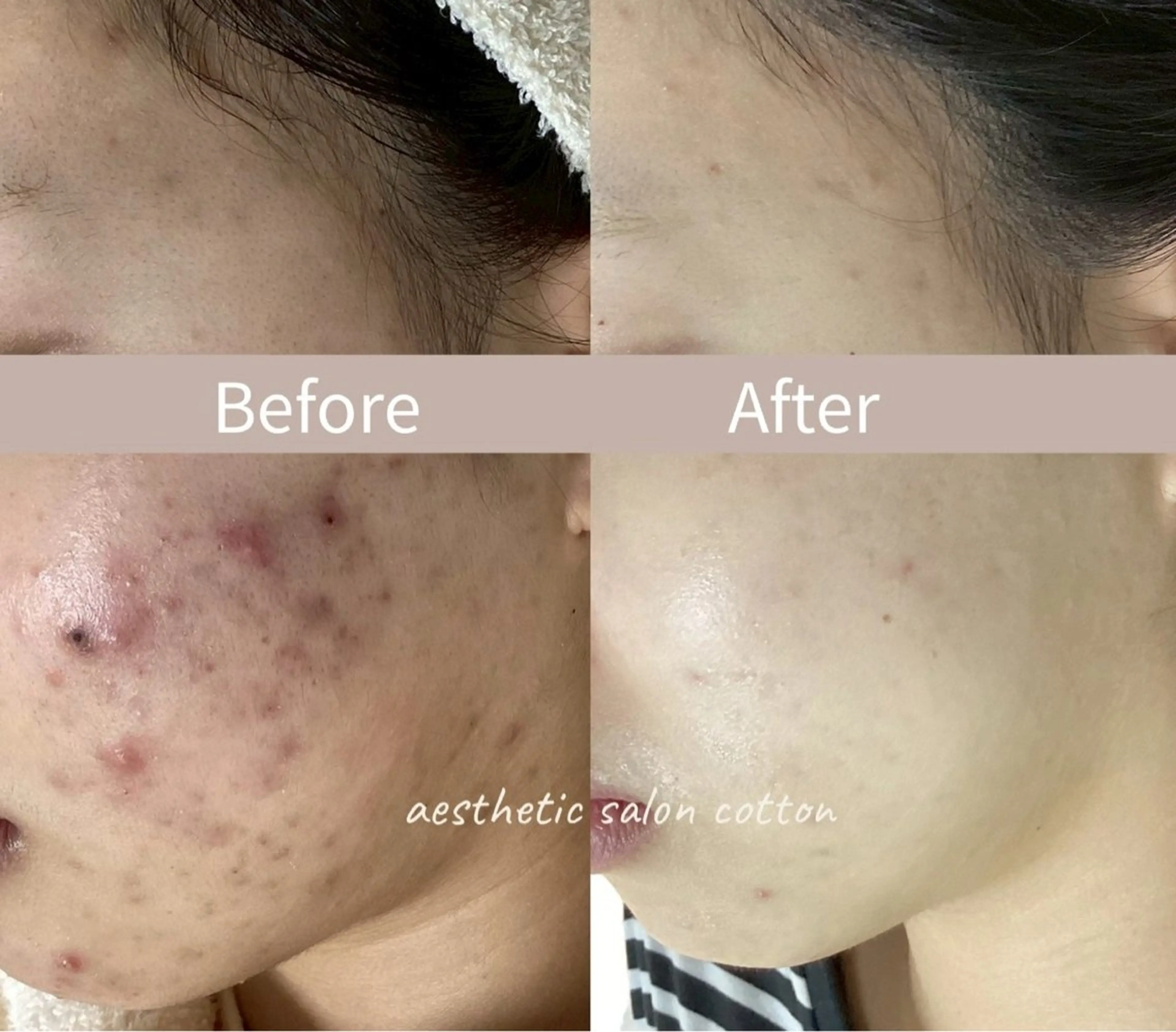 エステ 都度払い 肌質改善専門サロンのエステ・リラクイメージ