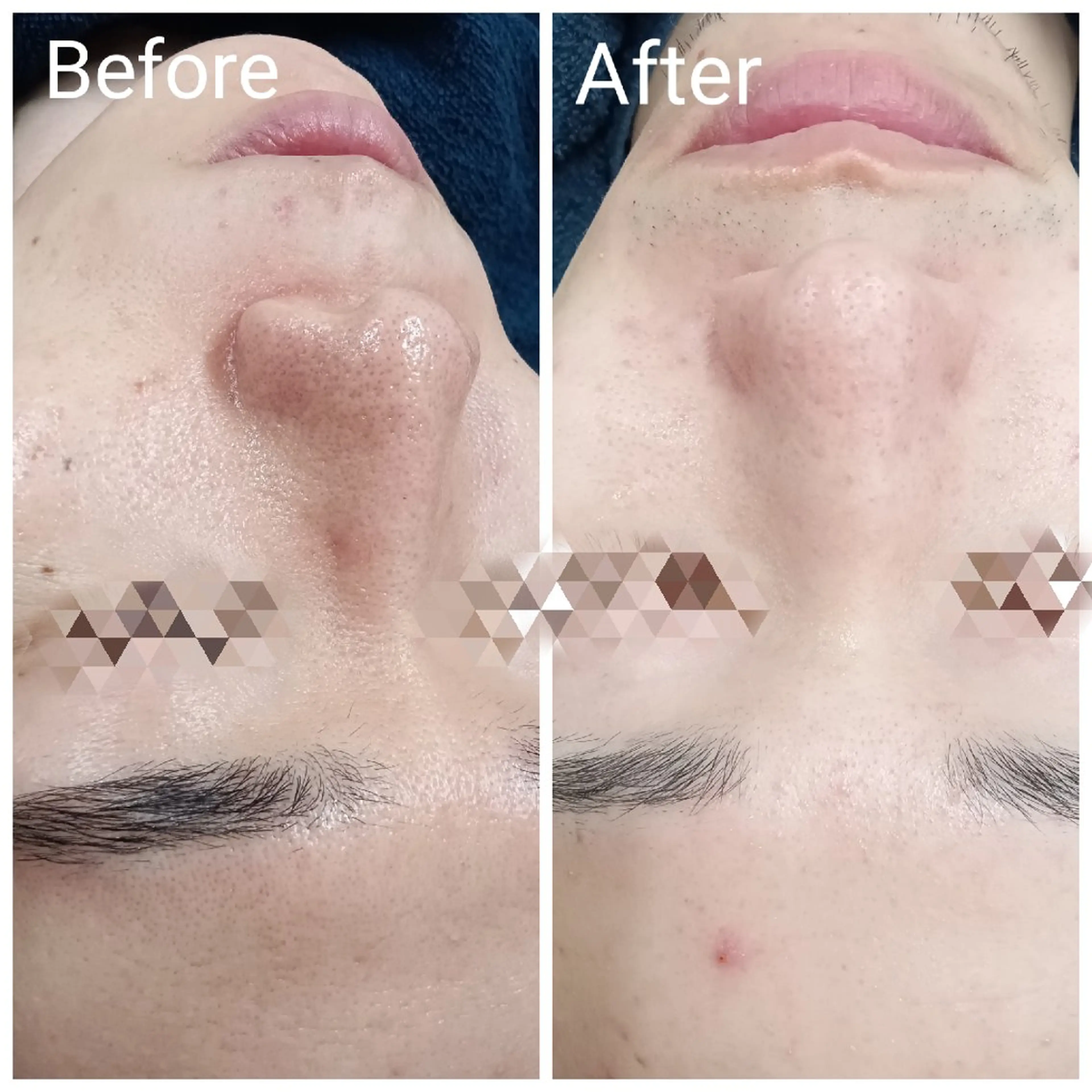 メンズ 肌質改善Beauty salon Renのエステ・リラクイメージ