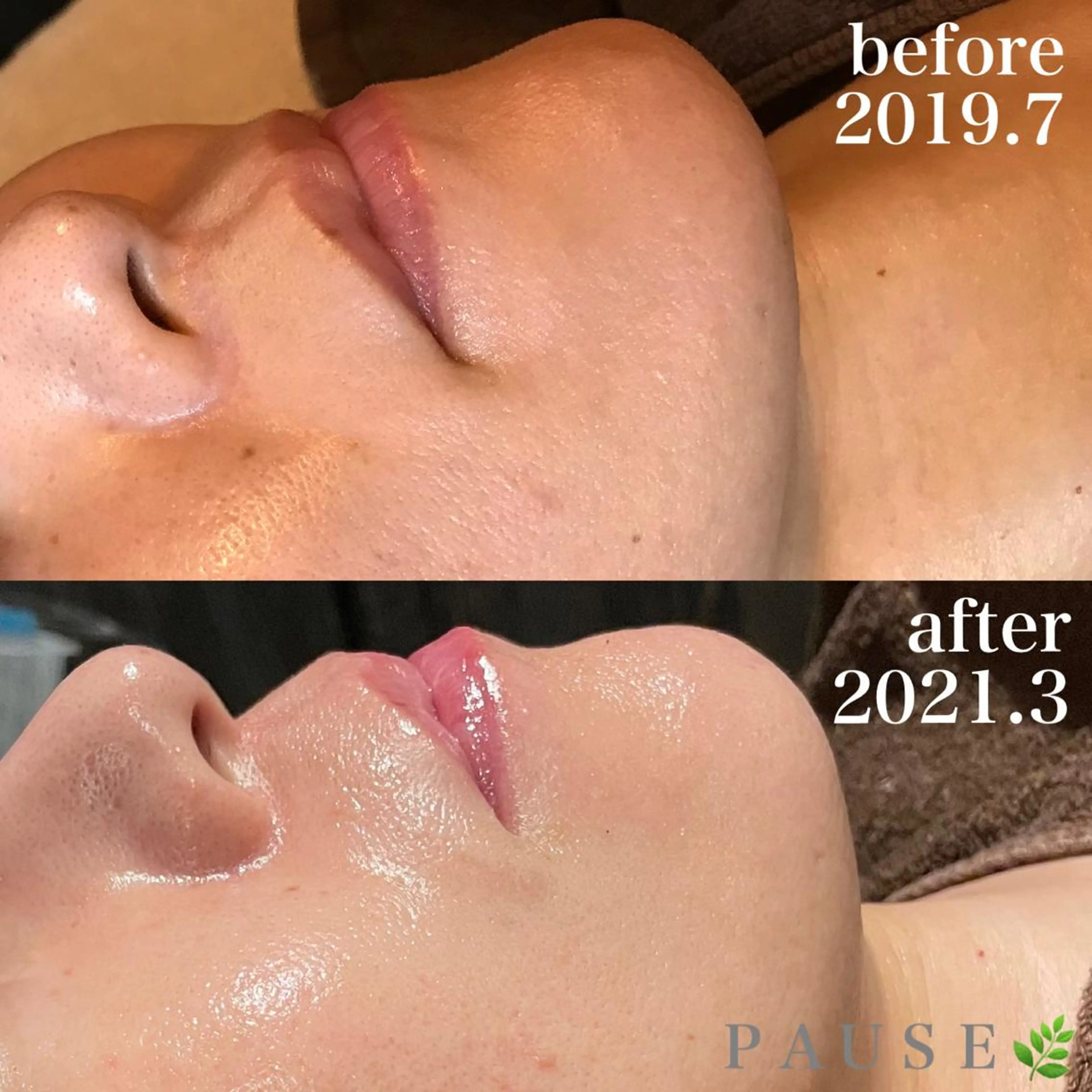 エステ 浜野 恵美のエステ・リラクイメージ