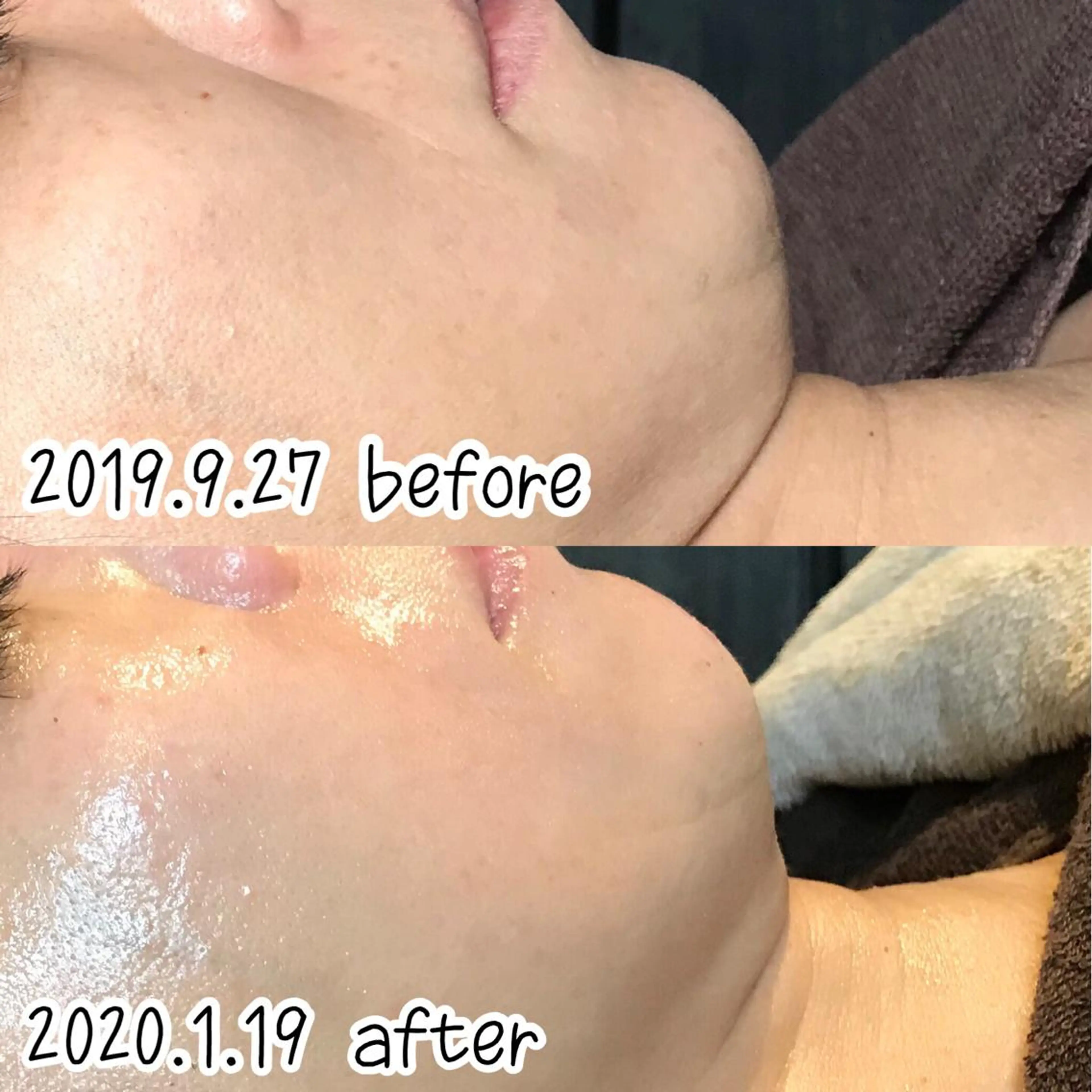 エステ 浜野 恵美のエステ・リラクイメージ