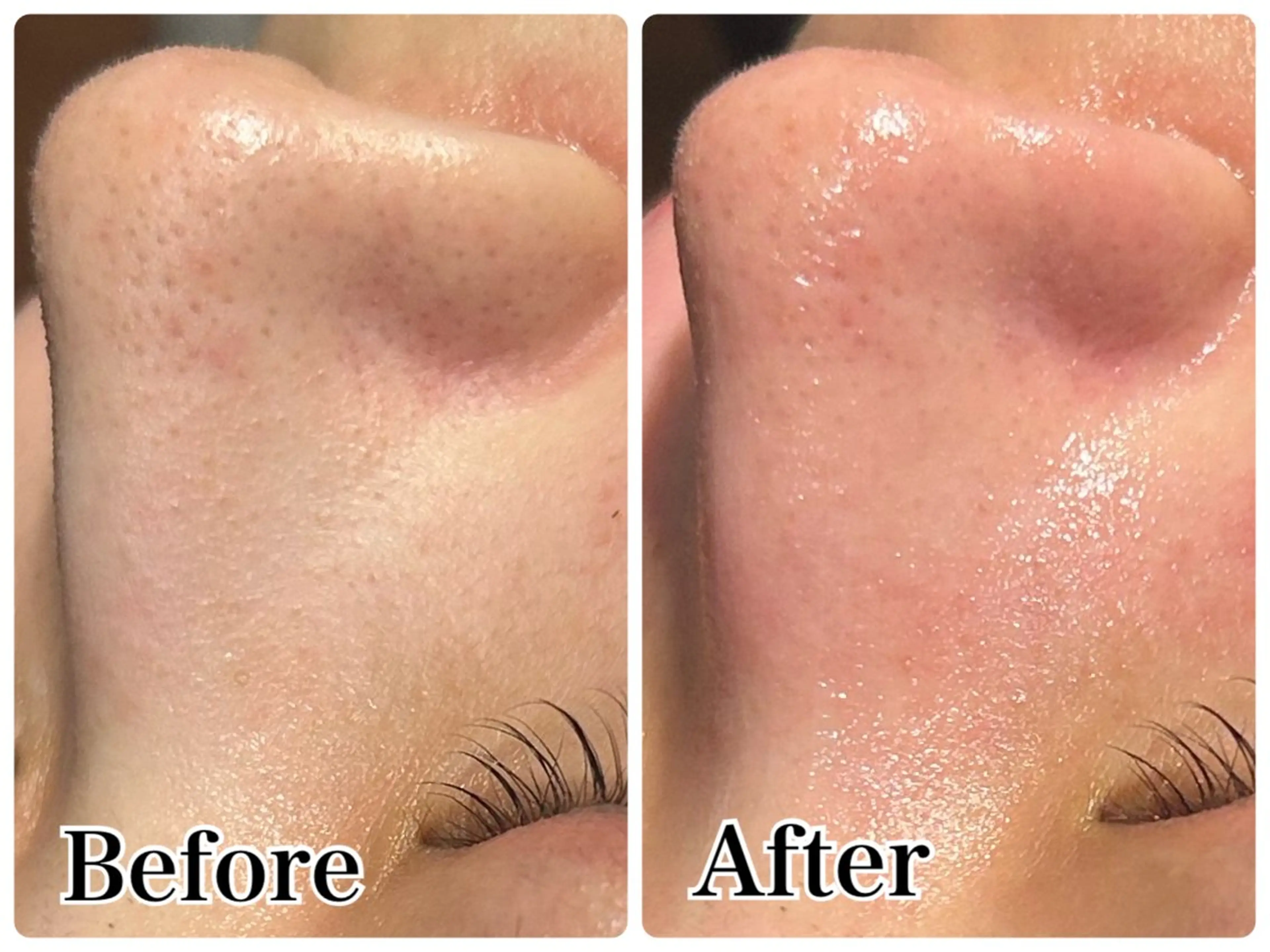 エステ Gemini MIKIのエステ・リラクイメージ