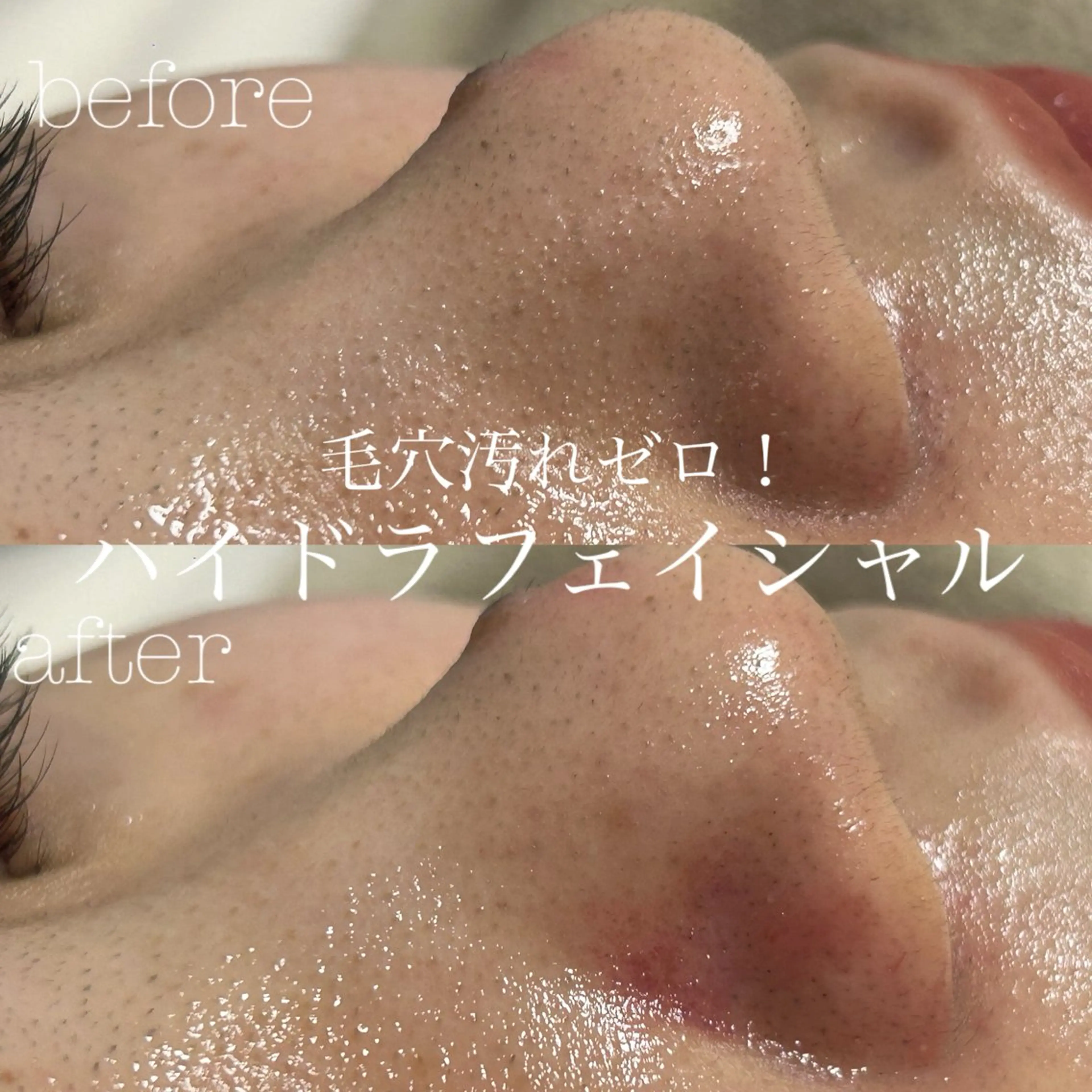 エステ フェイシャルサロン CHIARA 荒田のエステ・リラクイメージ