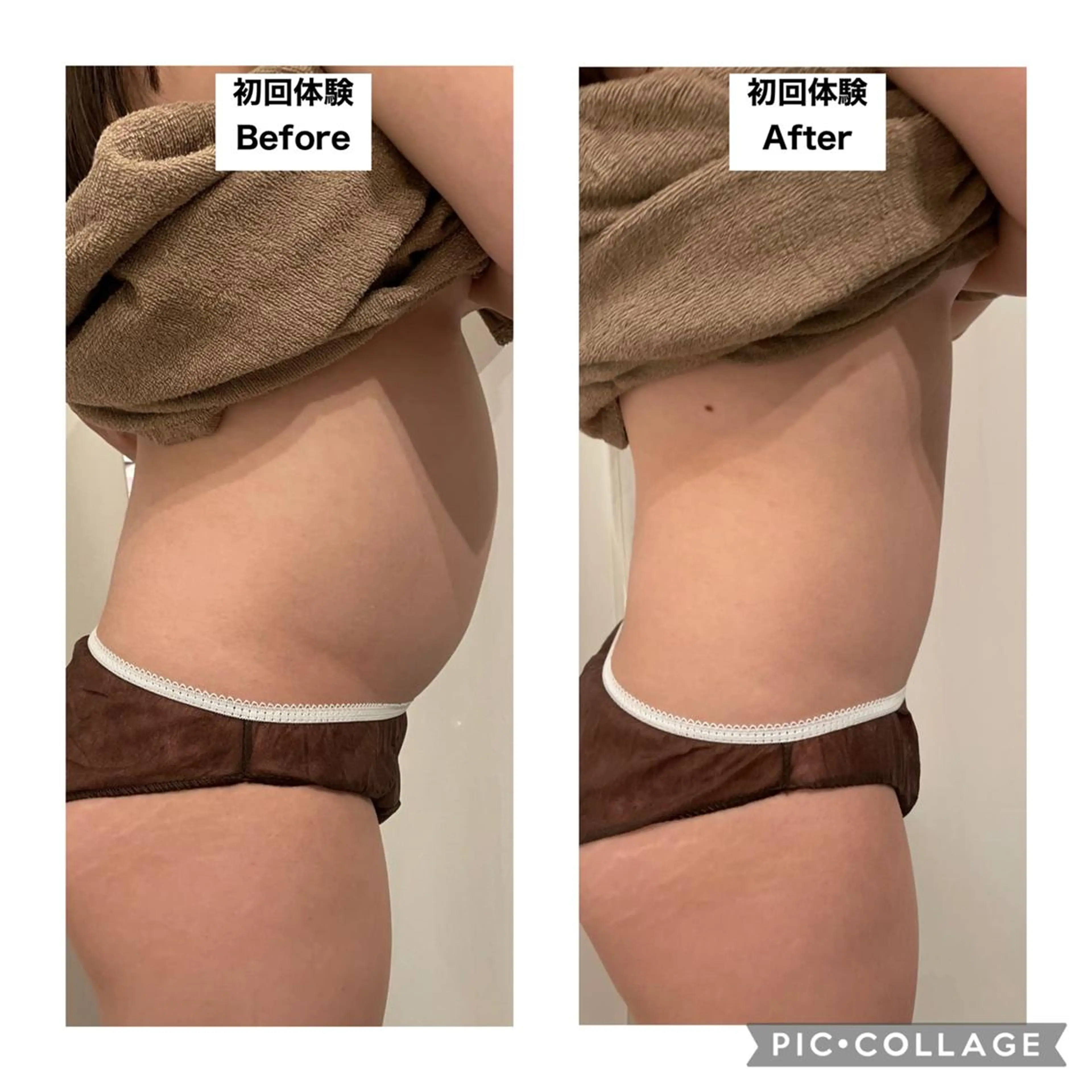 エステ リラク 12Dハイフ💗 最強小顔のエステ・リラクイメージ