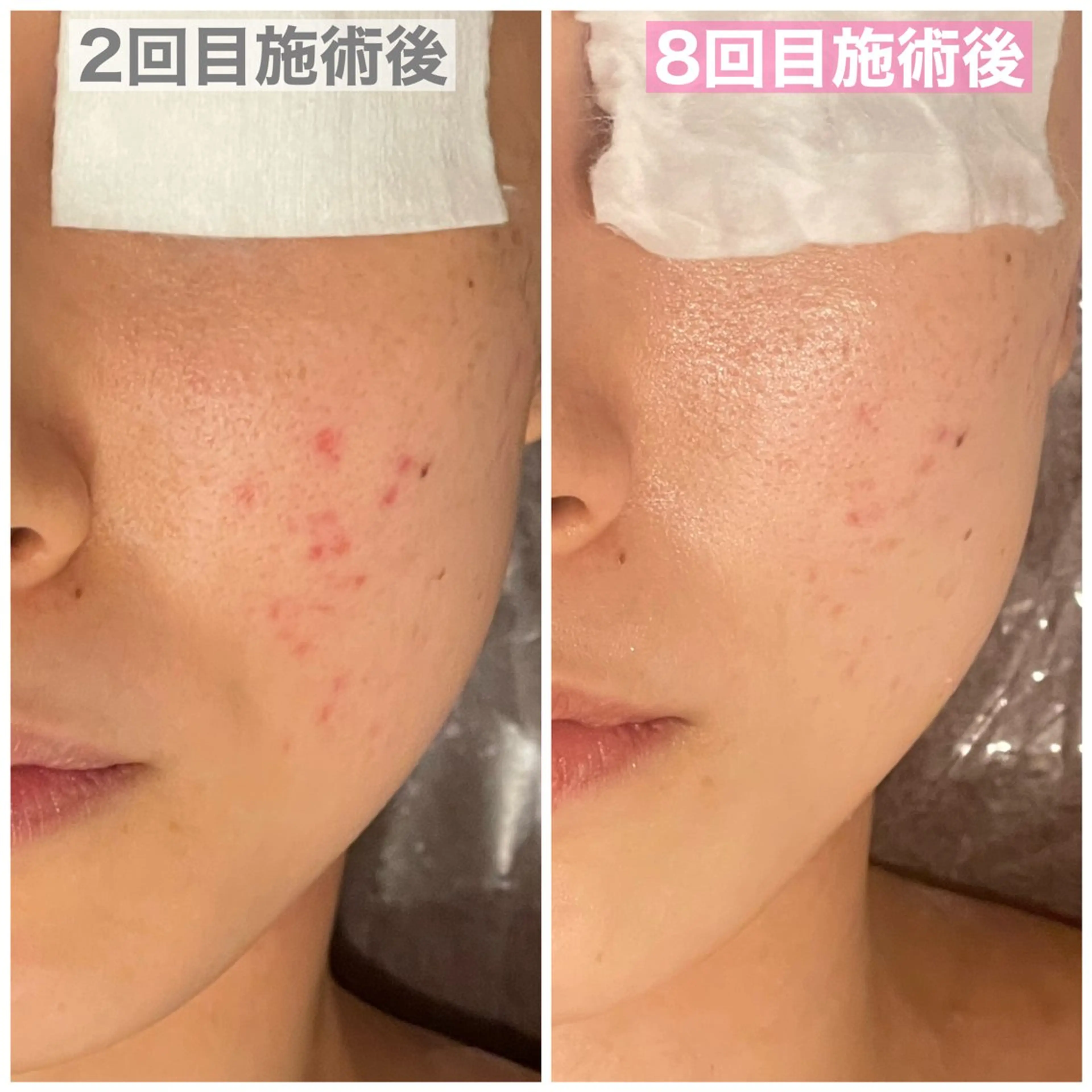 中尾 朱里のエステ・リラクイメージ