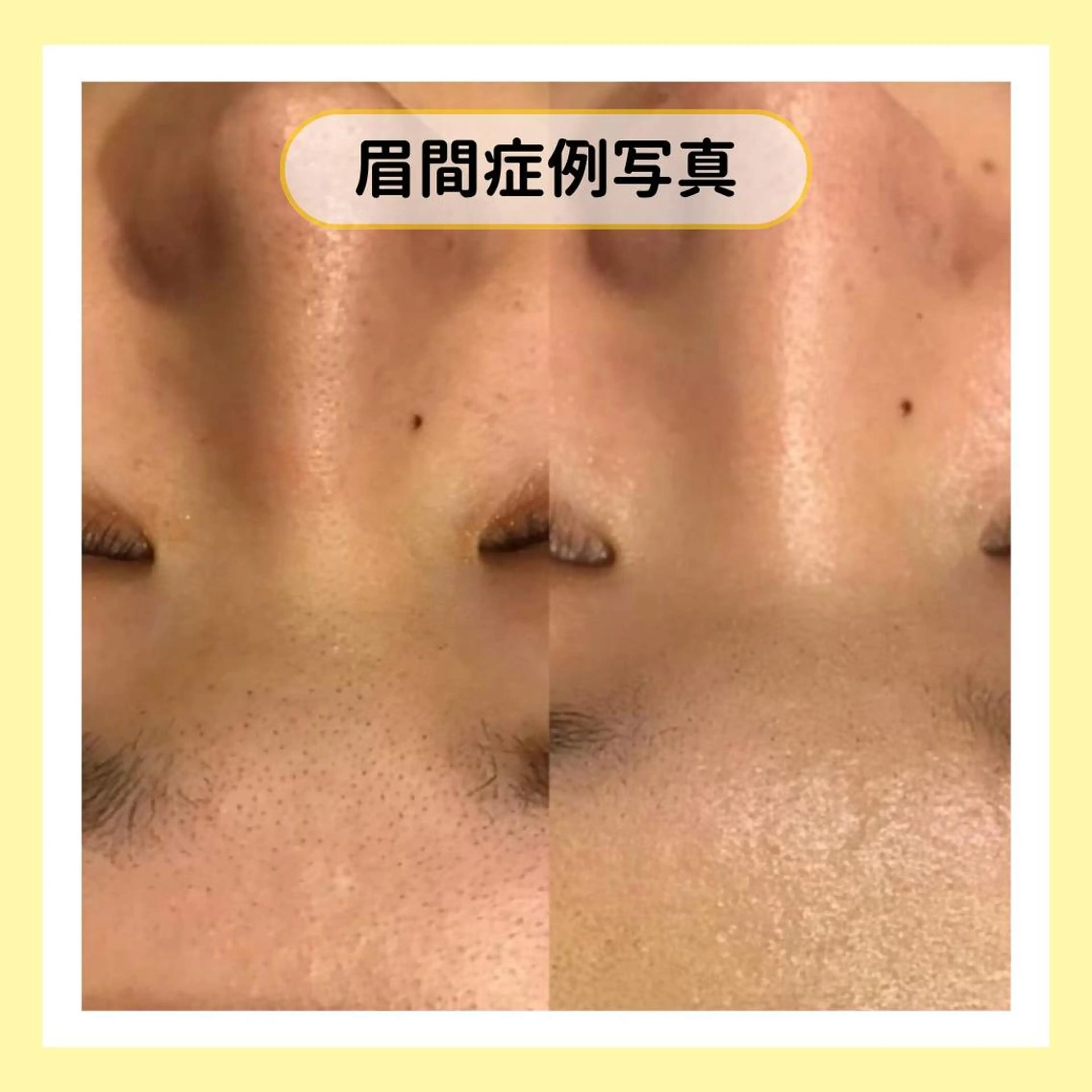 金山/脱毛/美肌 ULULUのエステ・リラクイメージ