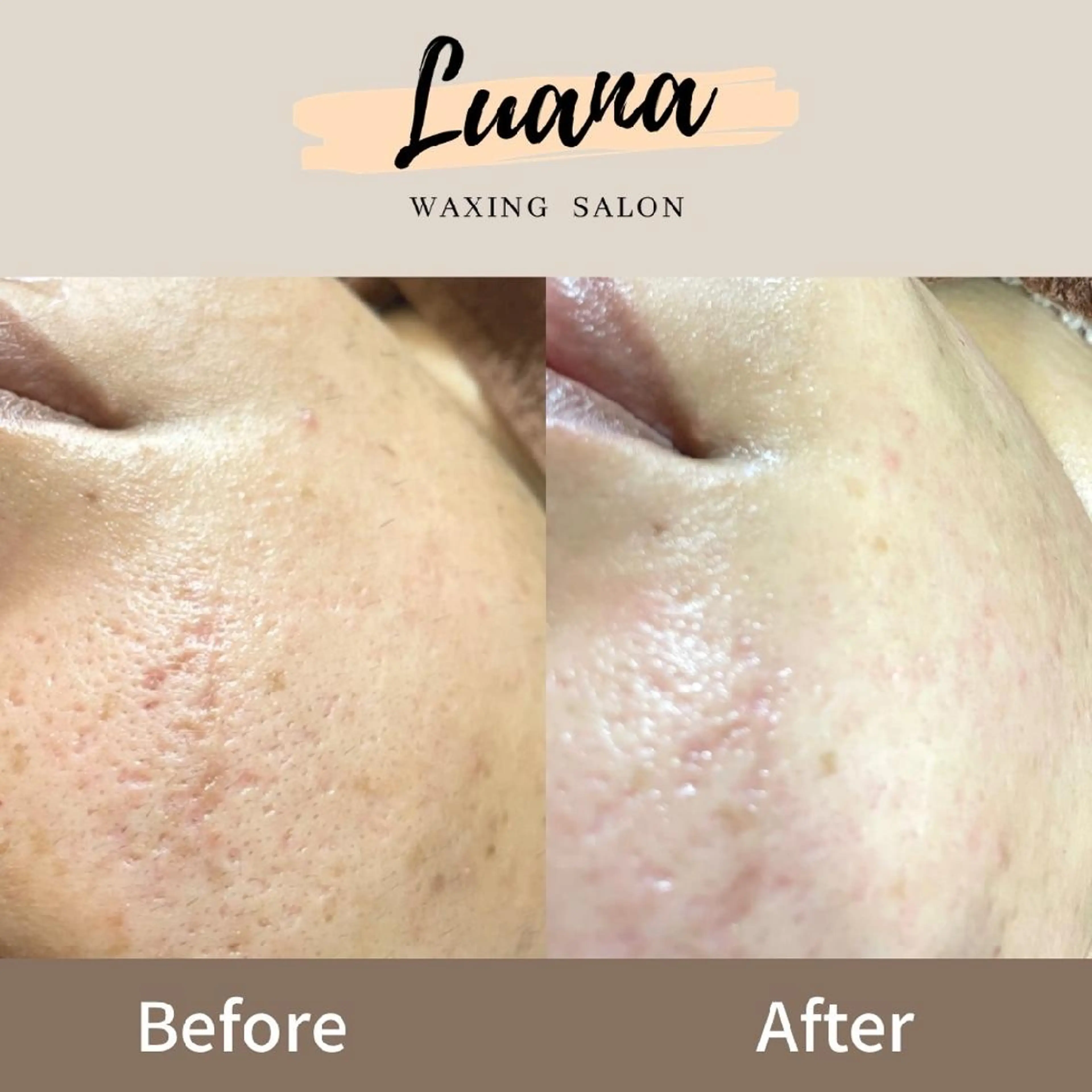 Luana wax 🐚根本のエステ・リラクイメージ