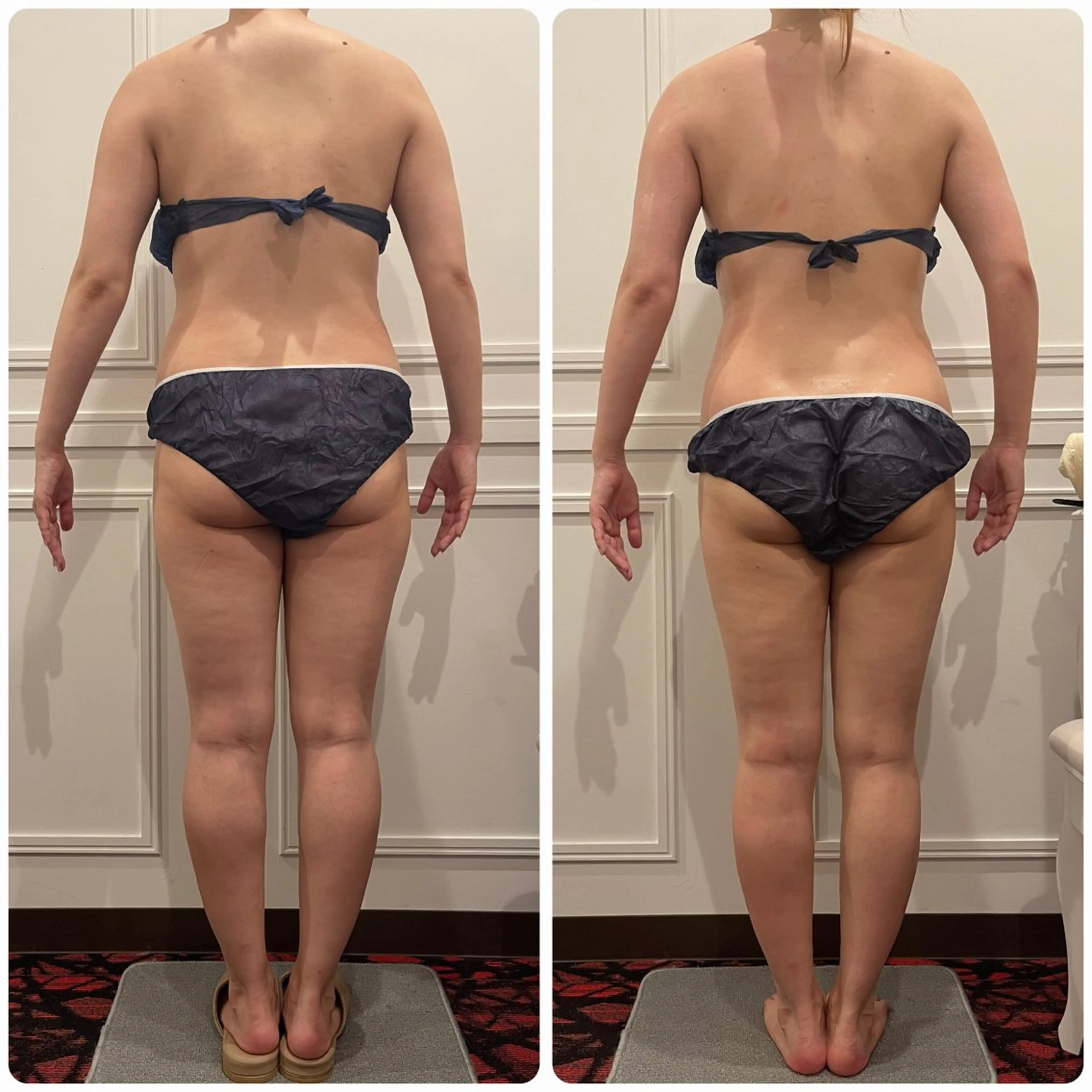 立体小顔×艶肌×美ボ ディ似合わせ施術 岡のエステ・リラクイメージ