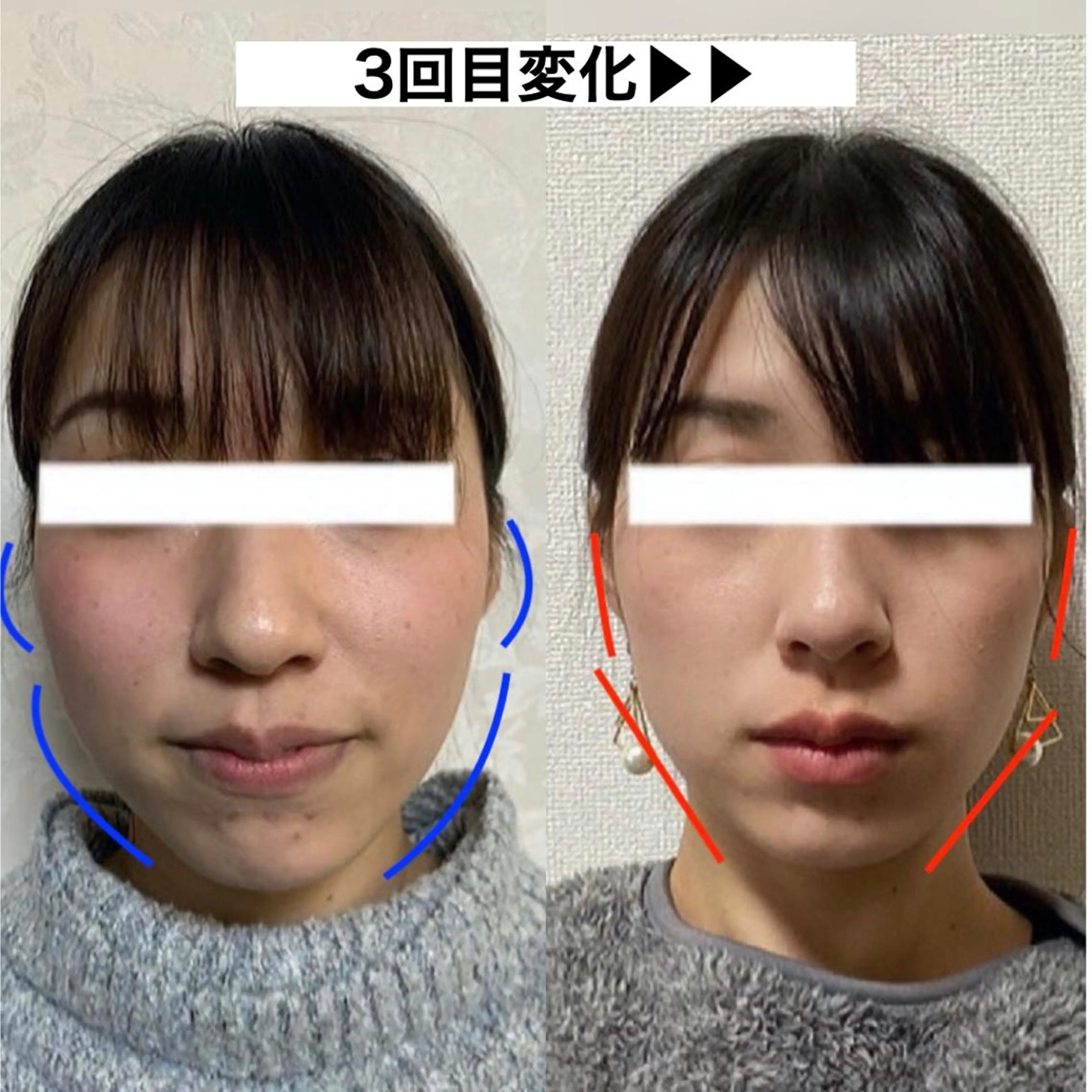 顔の歪み矯正専門 宮内翔のエステ・リラクイメージ