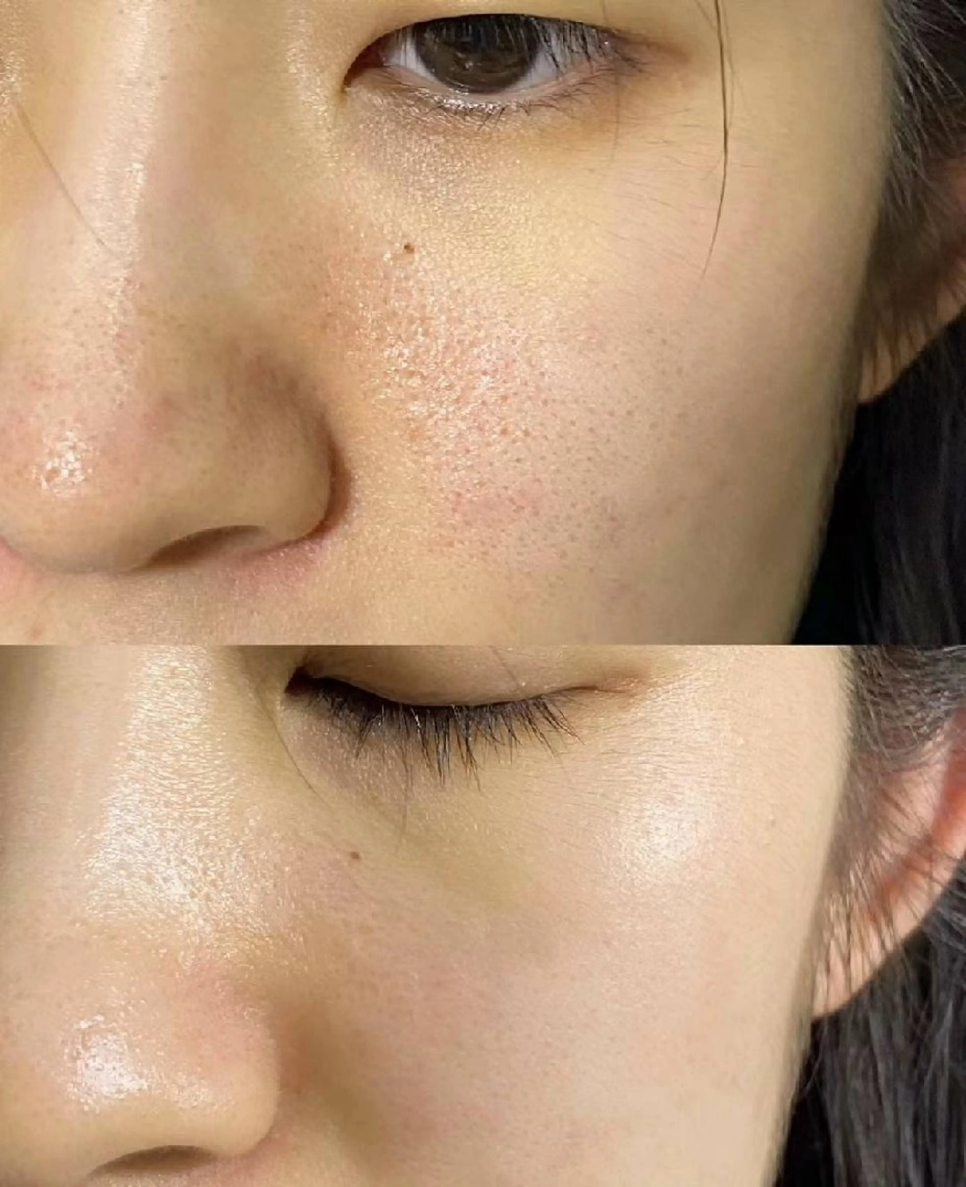 マツエク・マツパ 結婚式・ブライダル aliaハイフ&水光ジェットサロン所属・aliaハーブ水光店 エステティシャン募集のエステ・リラクイメージ