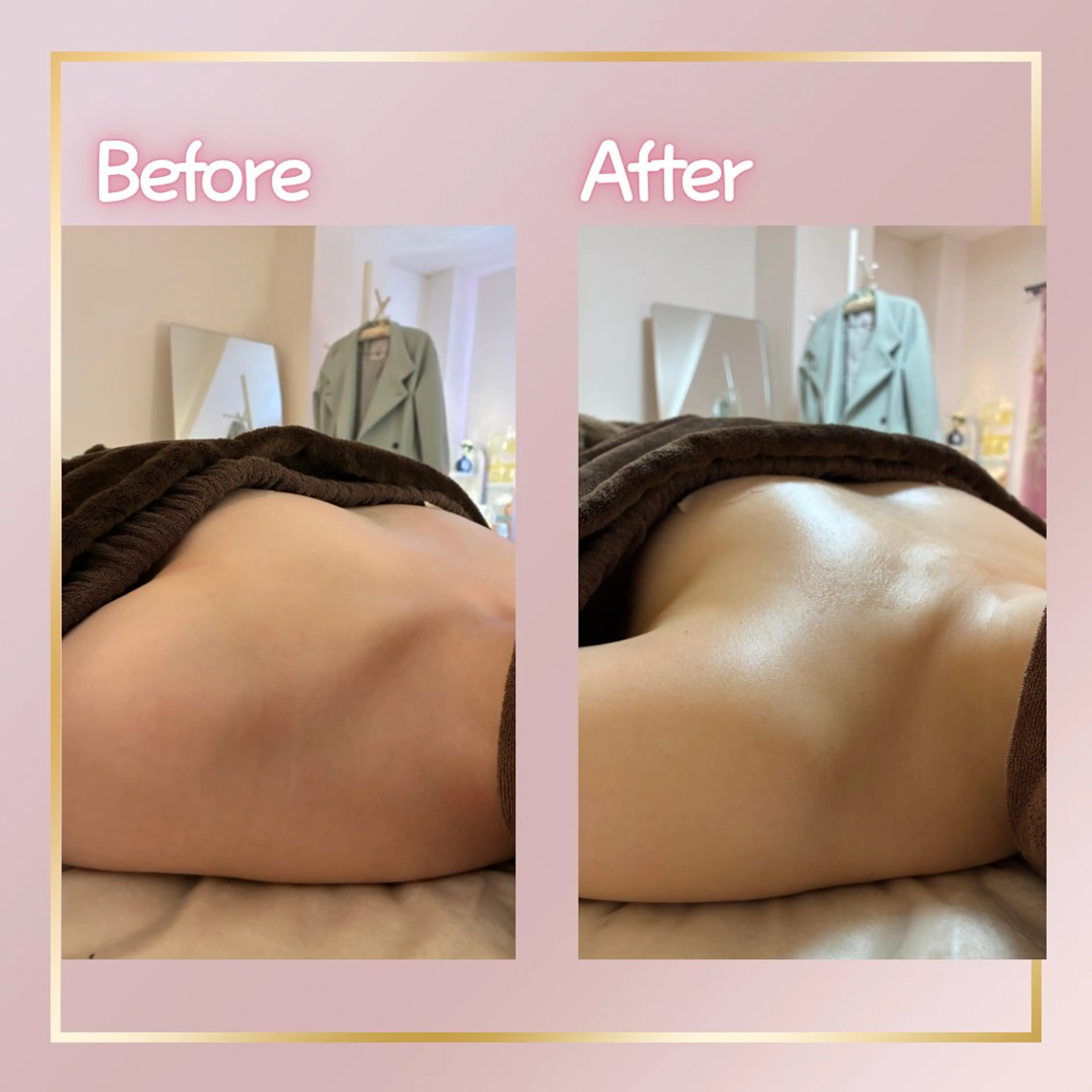 エステ 最新育乳マシン使用！ バストアップ専門店のその他イメージ