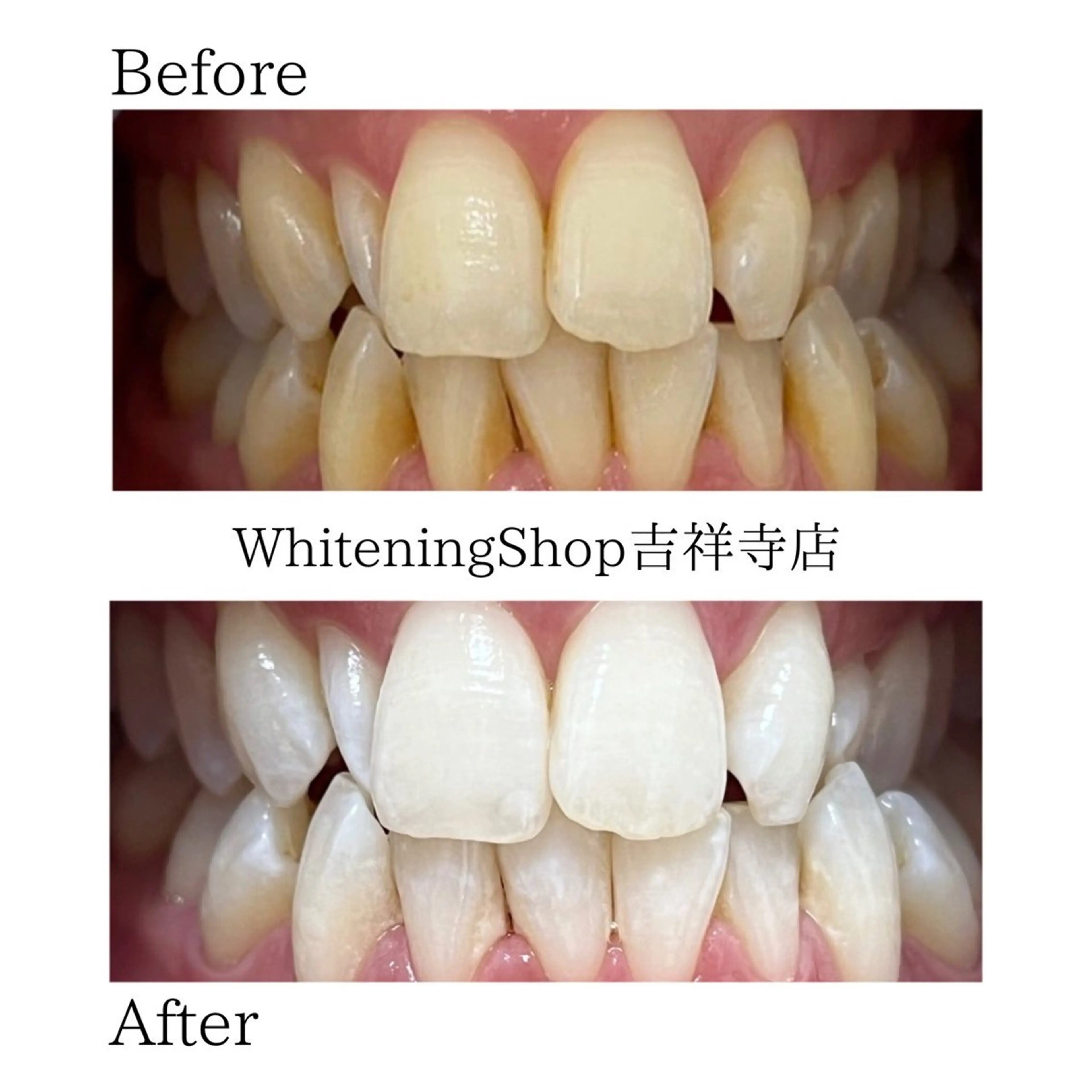 エステ リラク ホワイトニング ショップ吉祥寺店のエステ・リラクイメージ