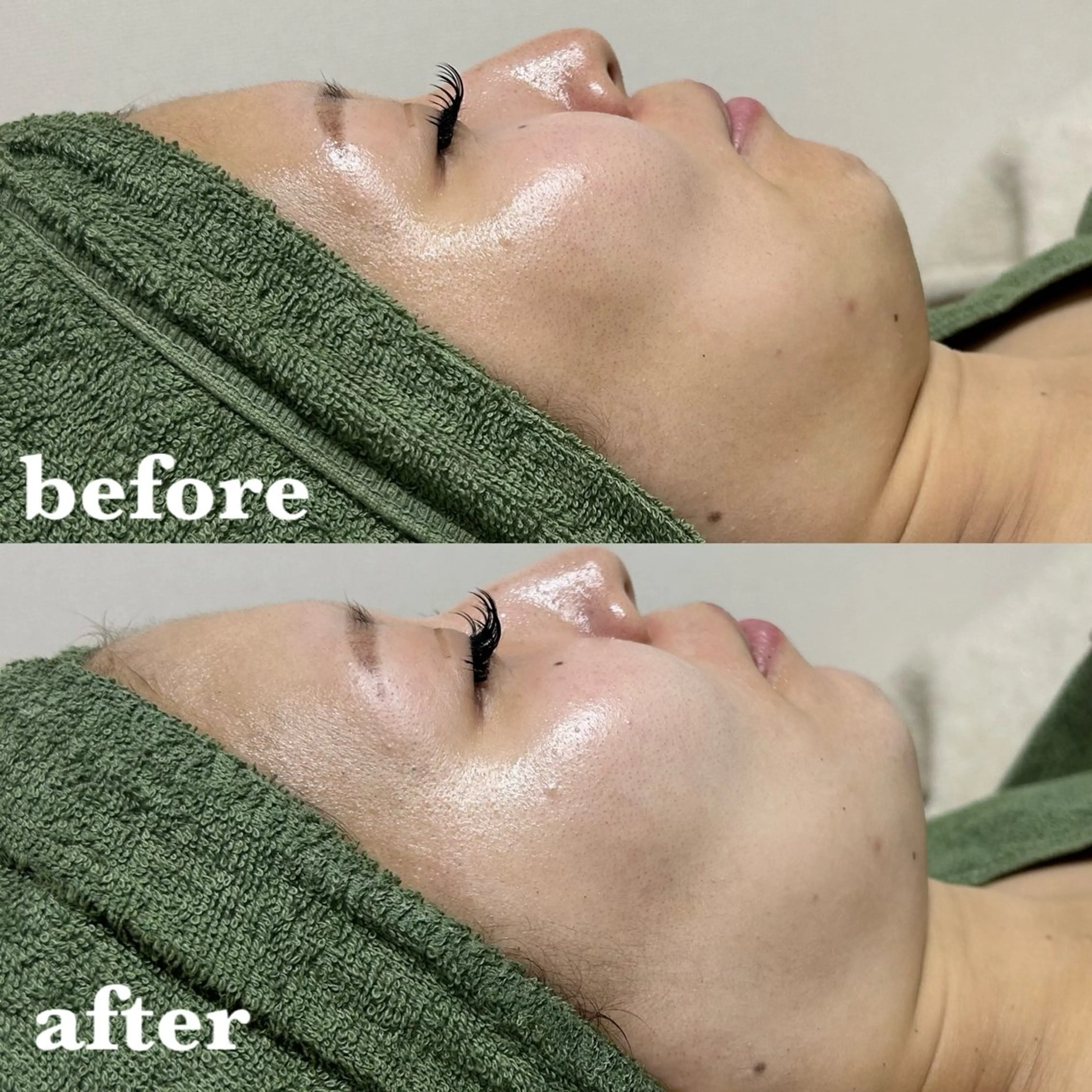 肌質改善＆脱毛 【M Mondo】のエステ・リラクイメージ