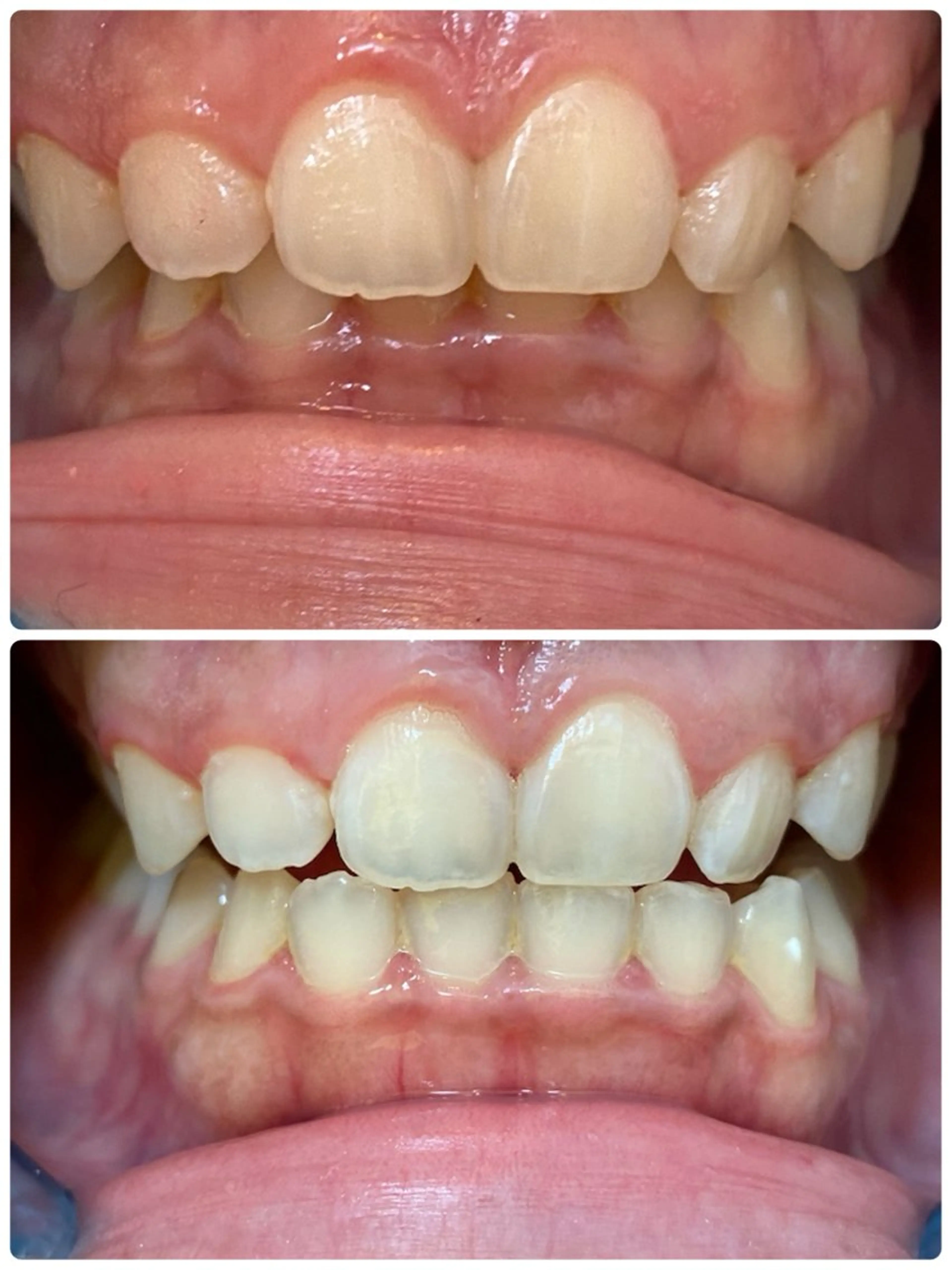 DIAMOND BEAUYのその他イメージ