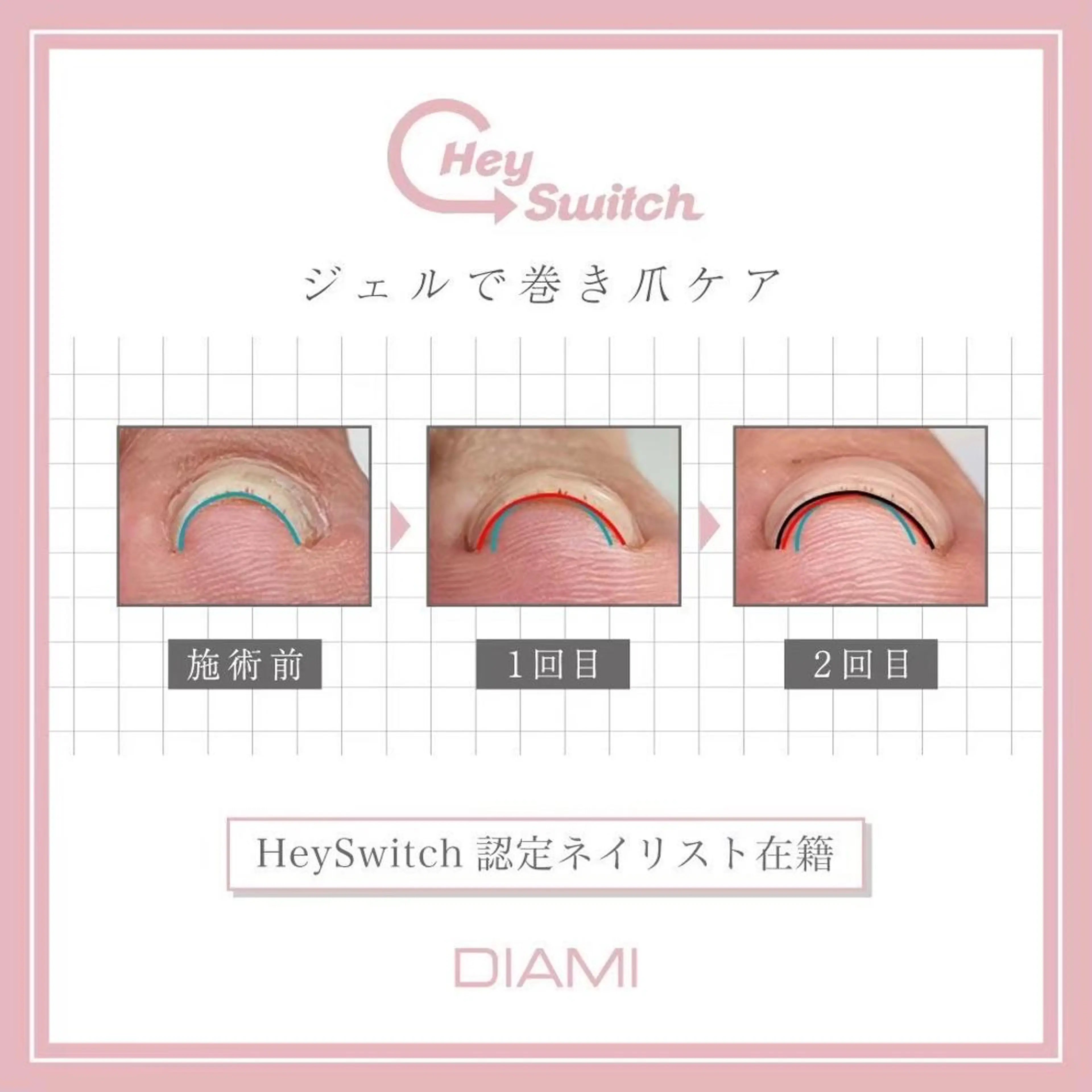 ネイル treat eyelash & nail salon 阪急西宮ガーデンズ店(別館)所属・treat 西北店のマツエク・マツパデザイン