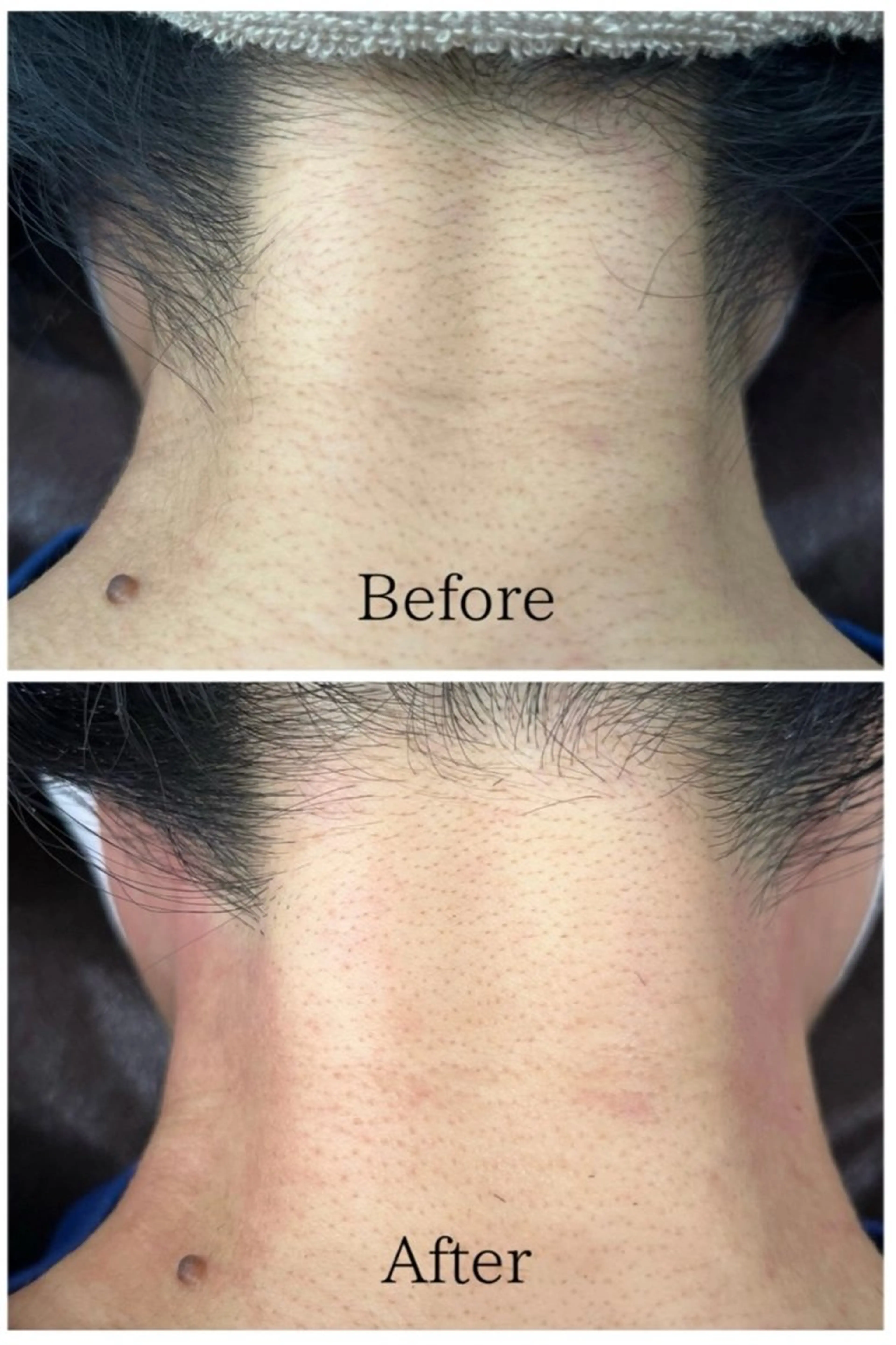 脱毛 LiLL by Andre beauty所属・LiLL 熊本のエステ・リラクイメージ