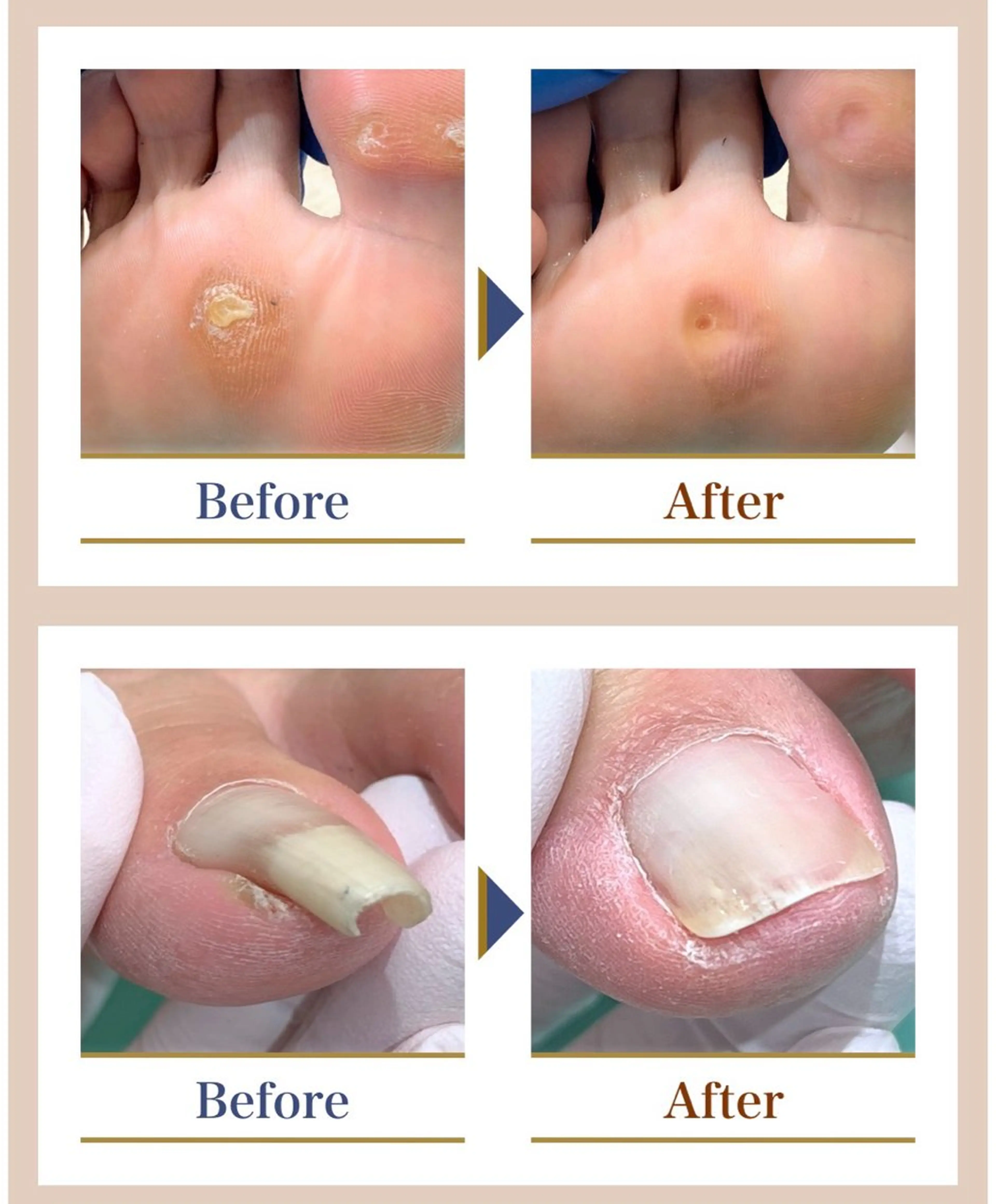 ネイル 巻き爪補正店 越谷店のネイルデザイン