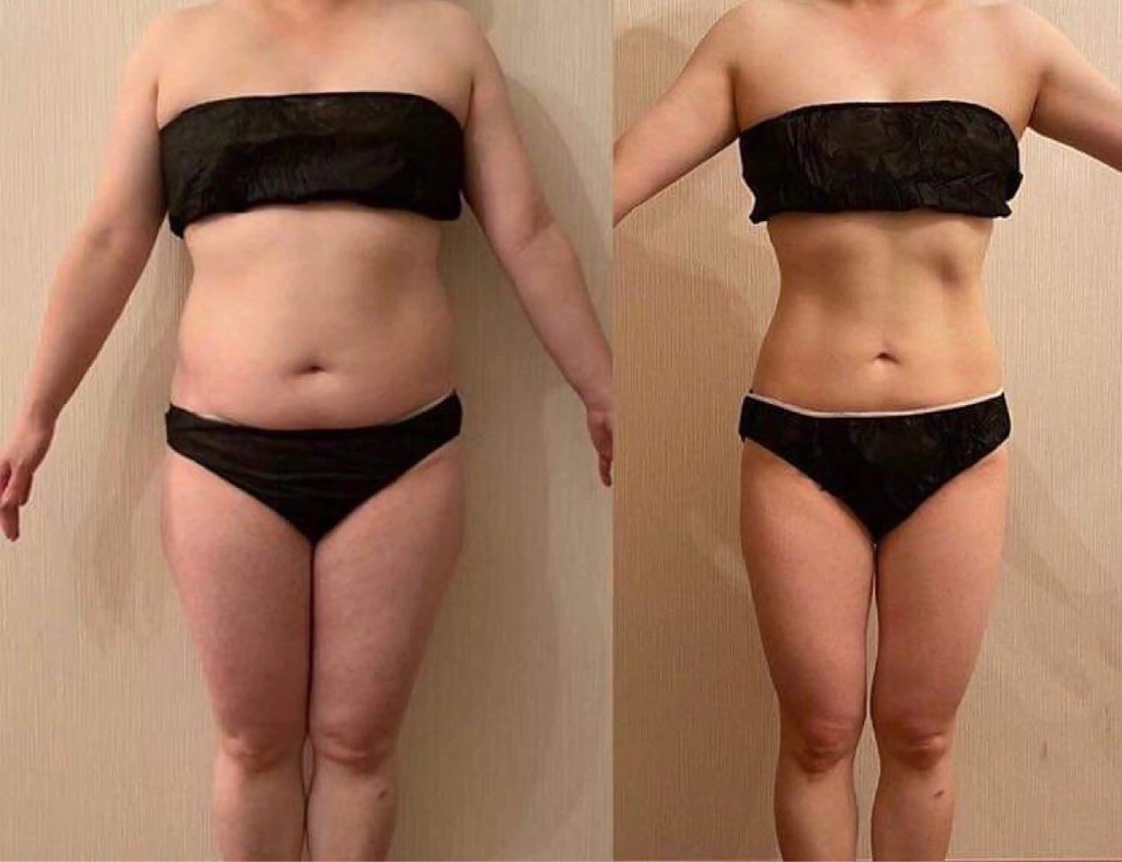 美肌，美ボディ，脱毛 サクラチャンスパのエステ・リラクイメージ