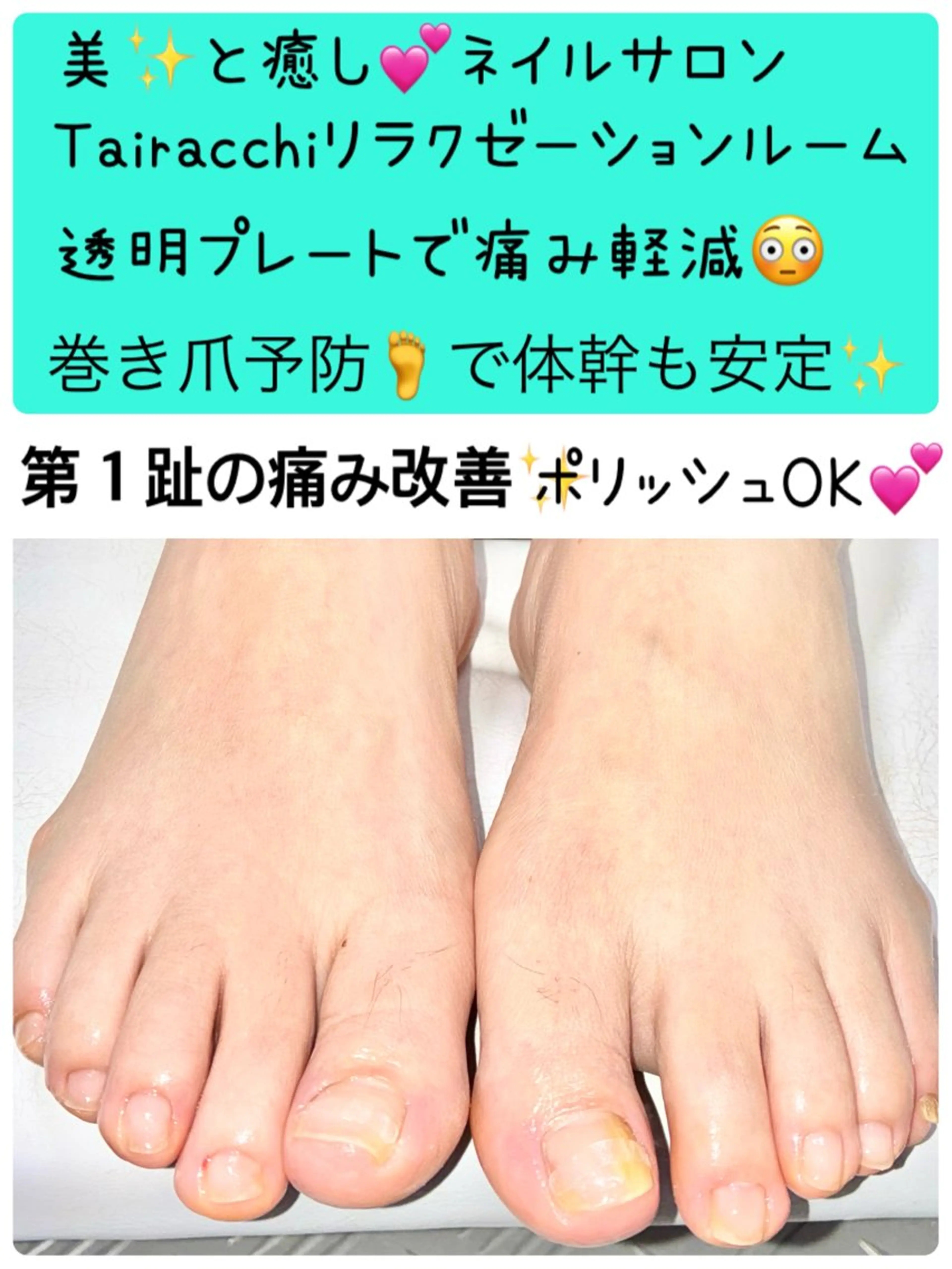 ネイル フットネイル Tairacchi タイラッチのネイルデザイン