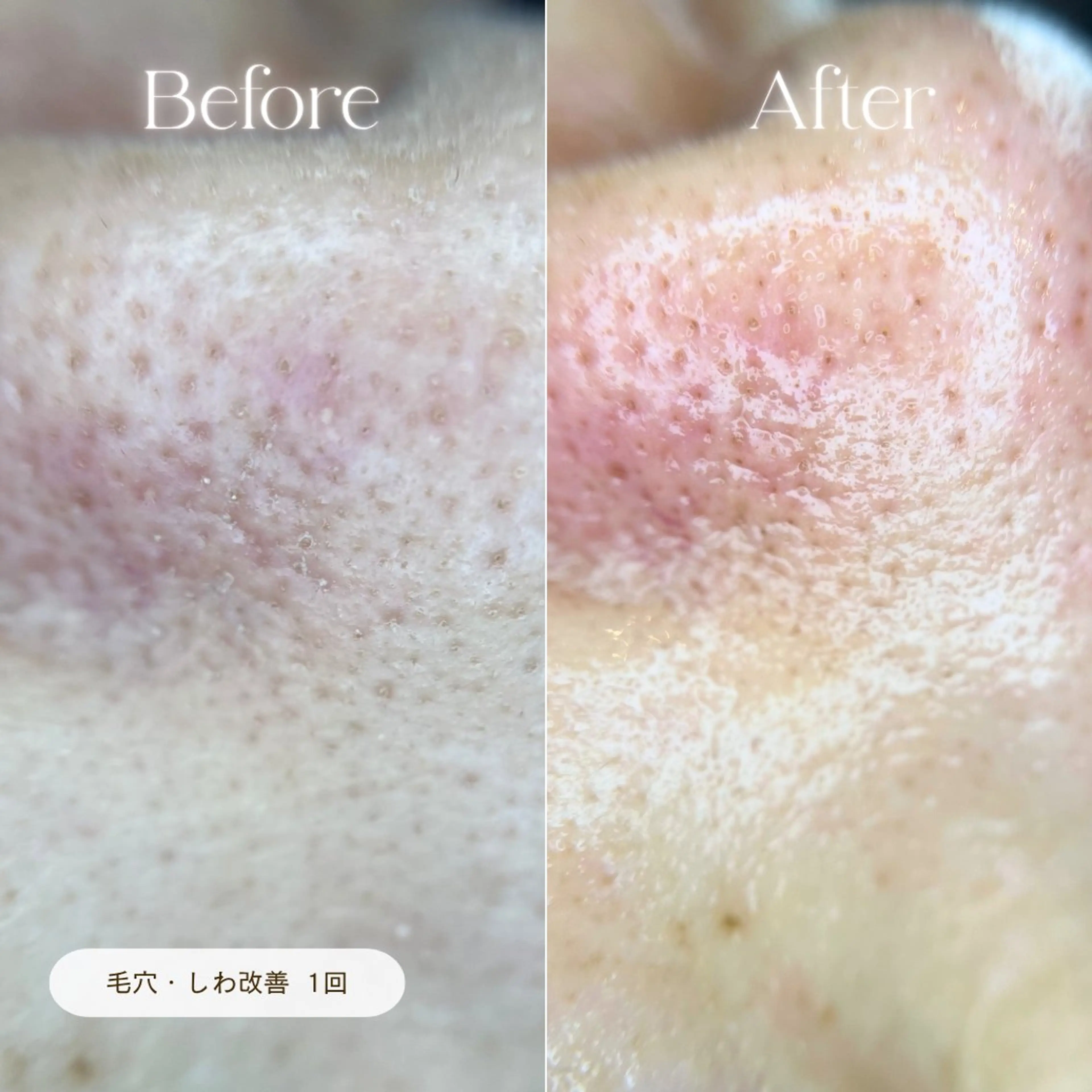 エステ リラク CURATED SKIN｜神戸三宮のエステ・リラクイメージ