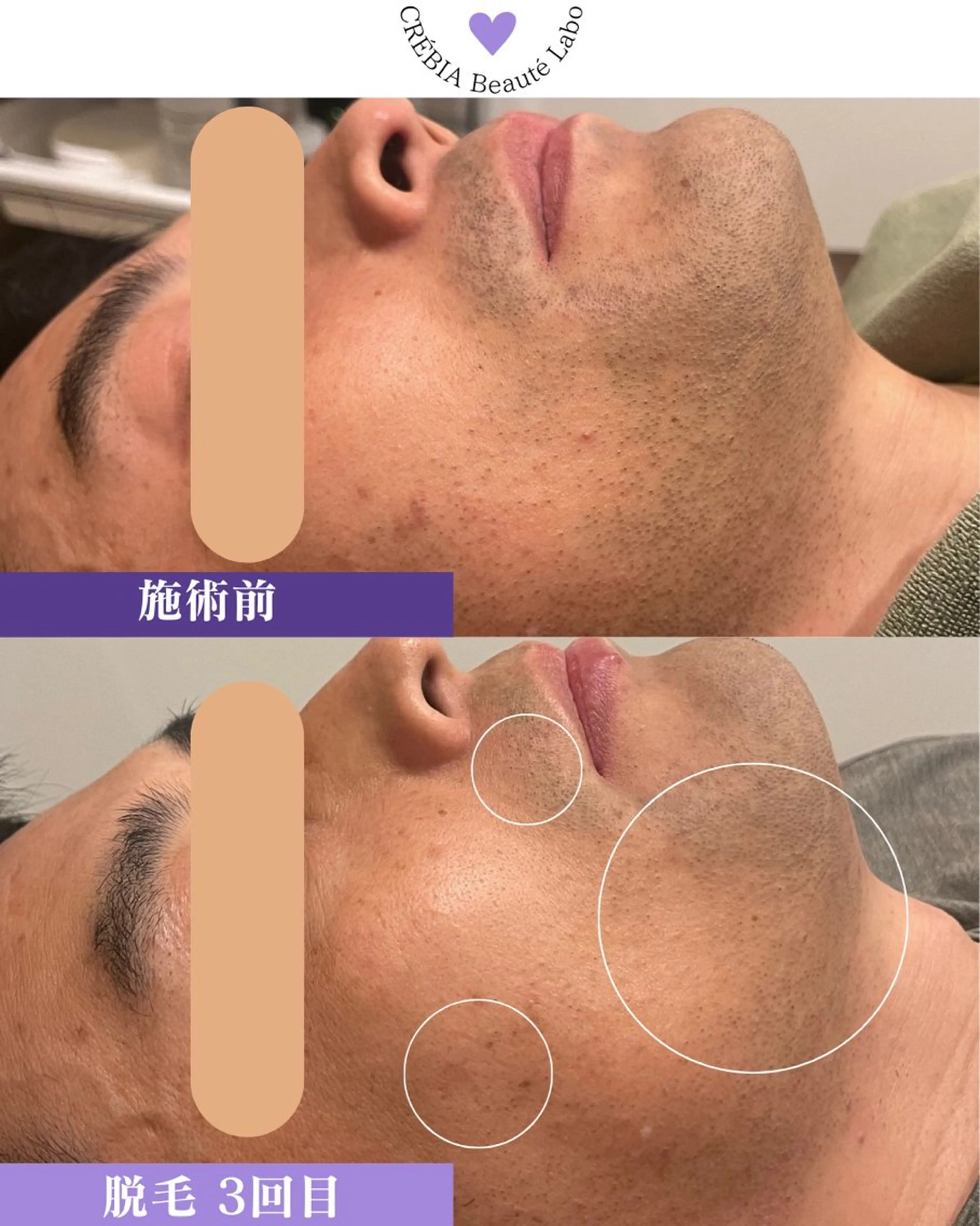 小顔＆まつ毛サロン AKANE❤️のエステ・リラクイメージ