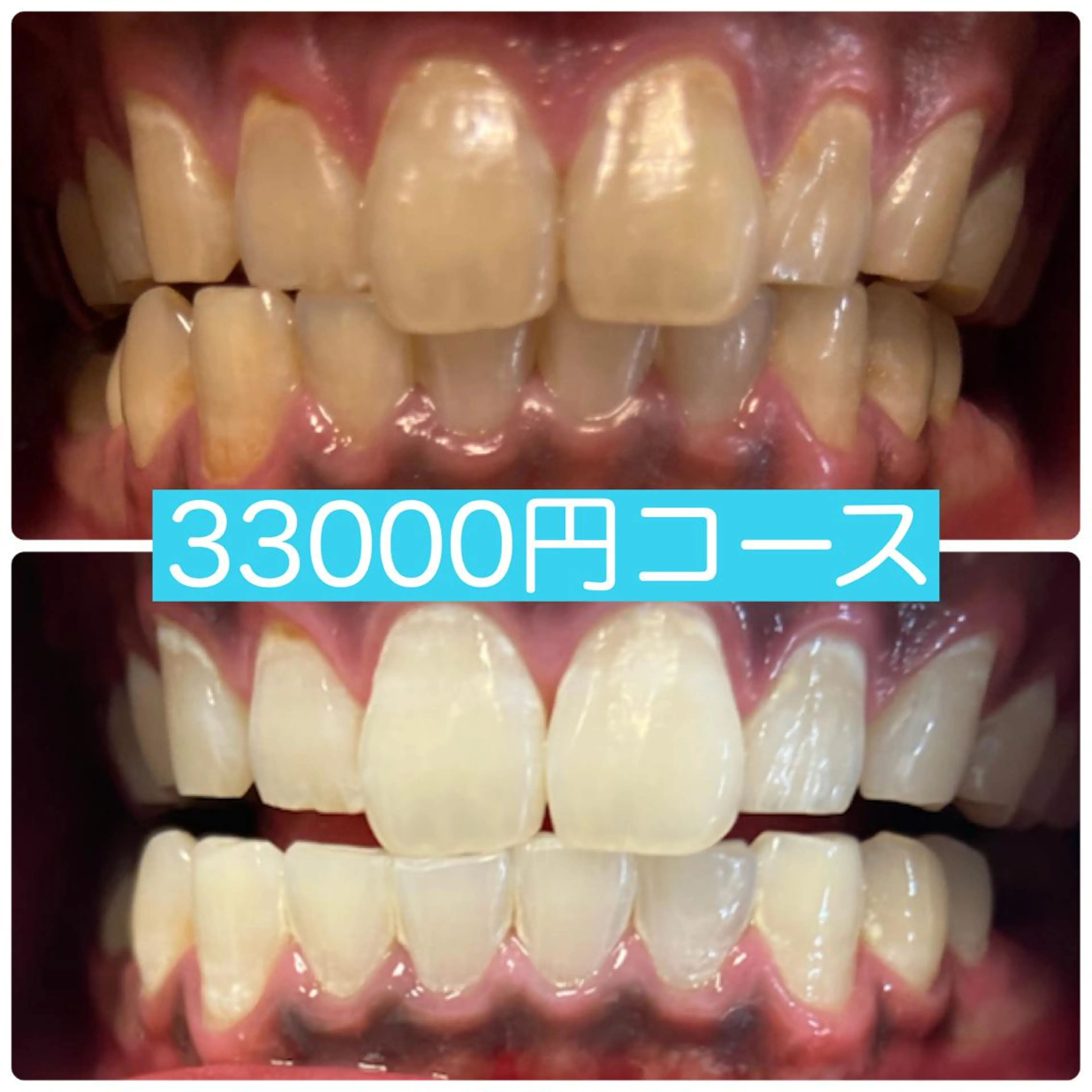 その他 PLATINUM Beauty 横浜店所属・ホワイトニングルーム 横浜店のその他イメージ