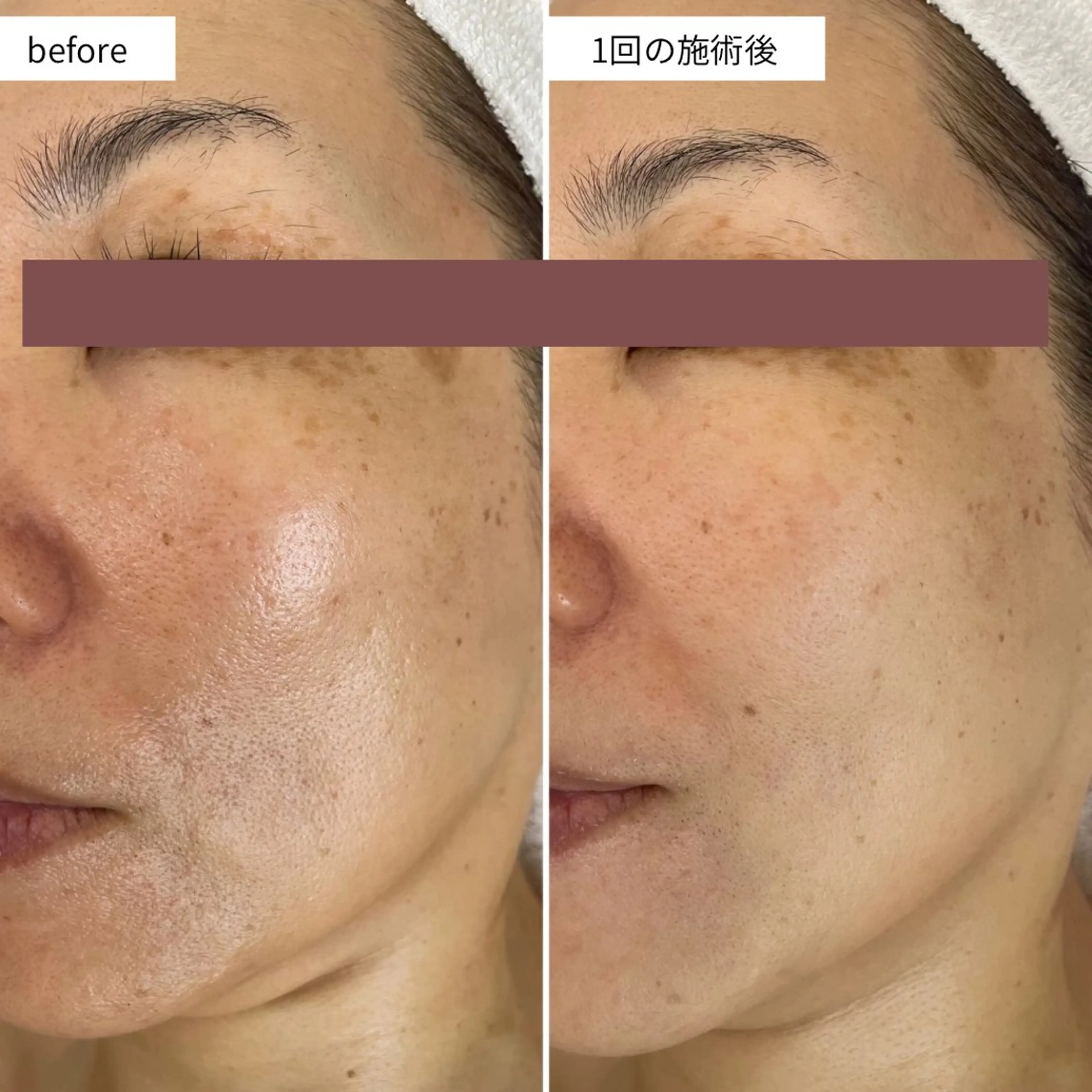 シミ・毛穴ケア専門 クロヌYUKIのエステ・リラクイメージ