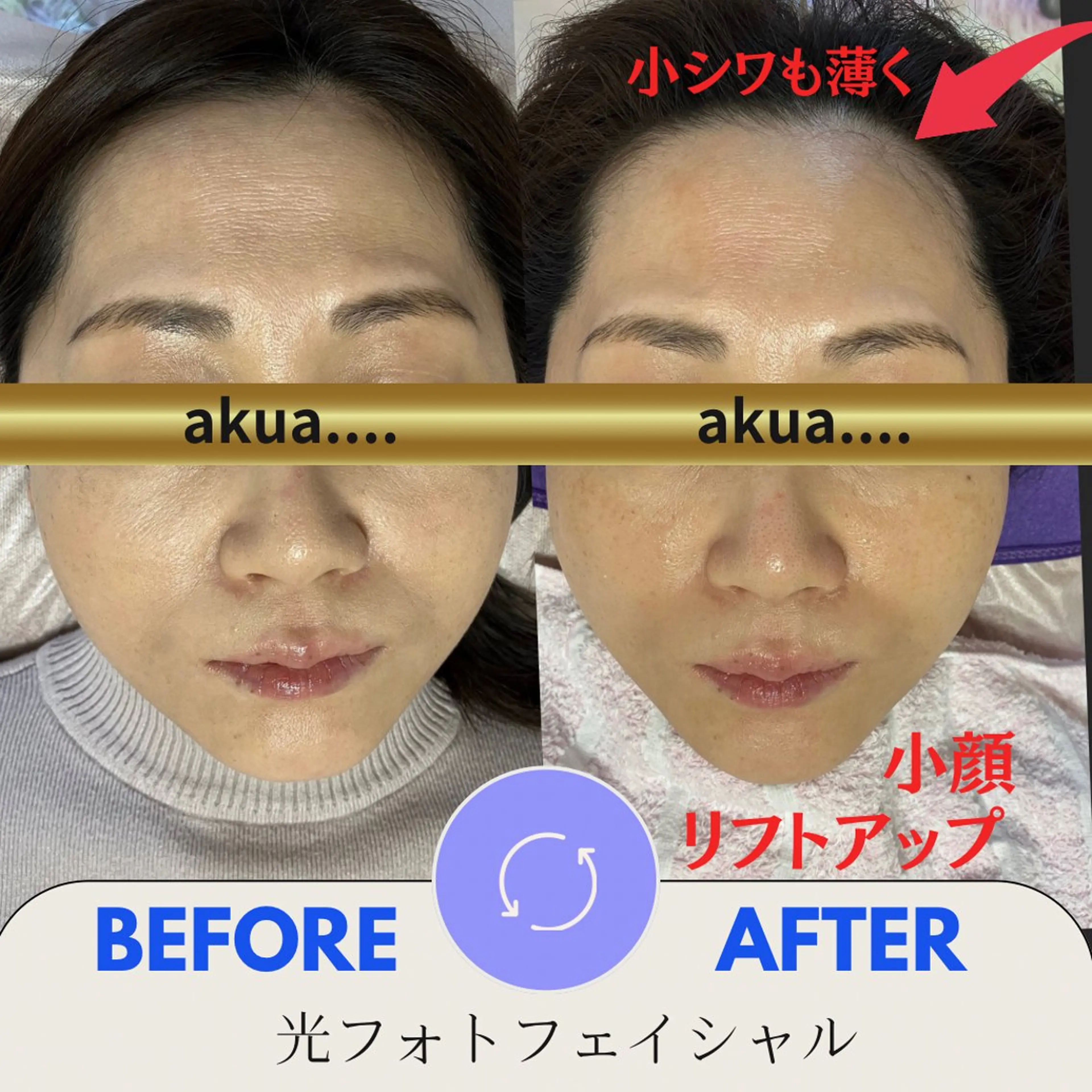 その他 akua... 【肌質管理専門】のその他イメージ