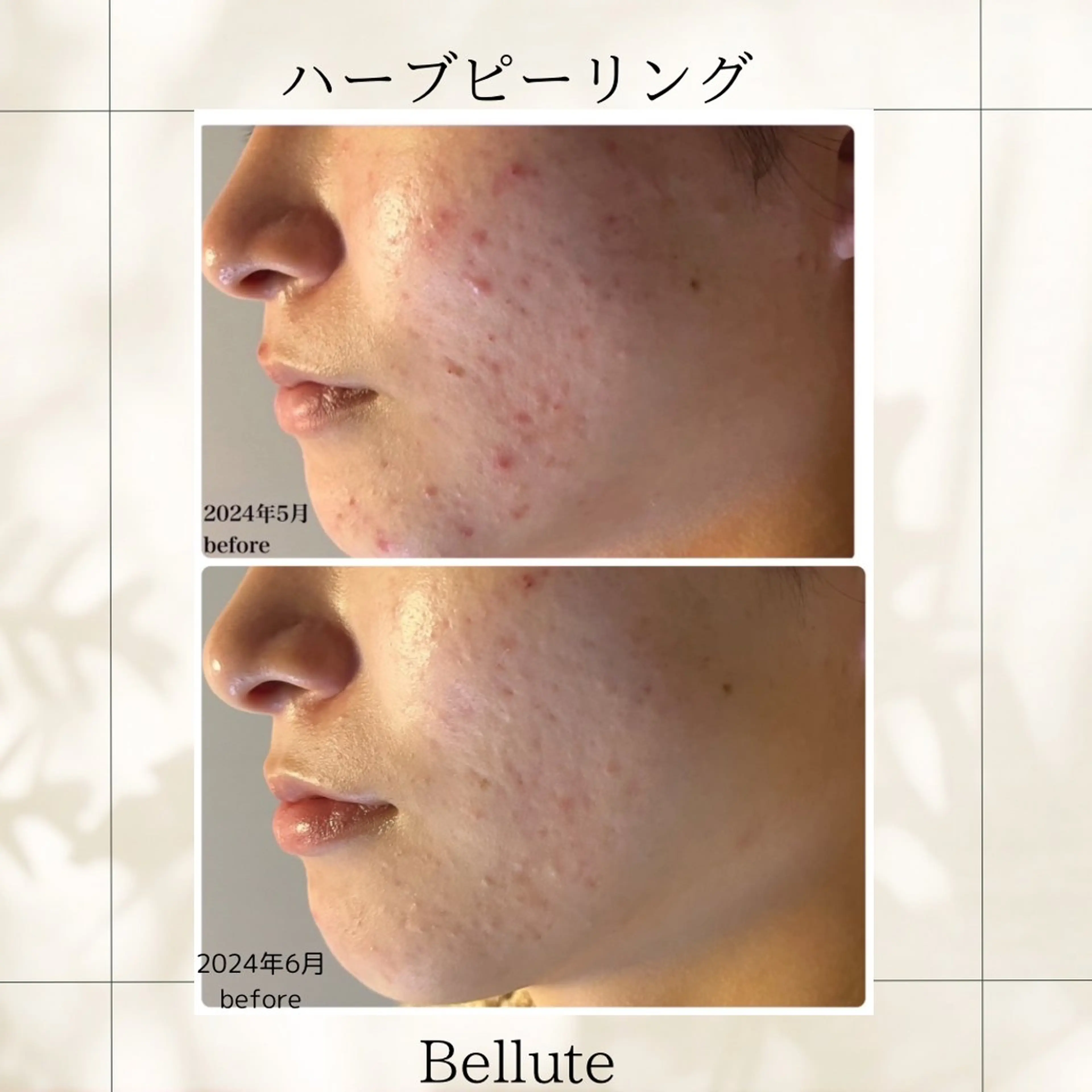 エステ リラク ピーリング専門店 Belluteのエステ・リラクイメージ