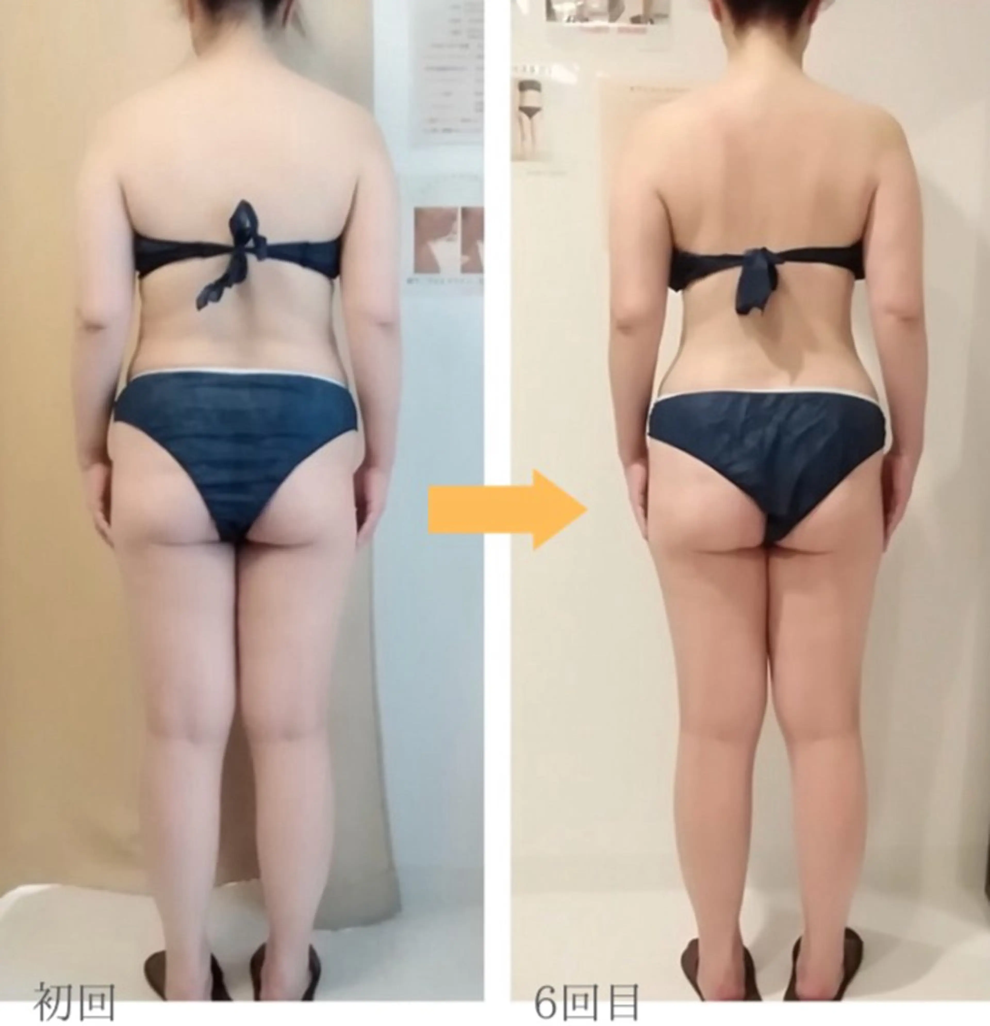 エステ リラク 根本痩せ痩身サロン Rosemaryのエステ・リラクイメージ