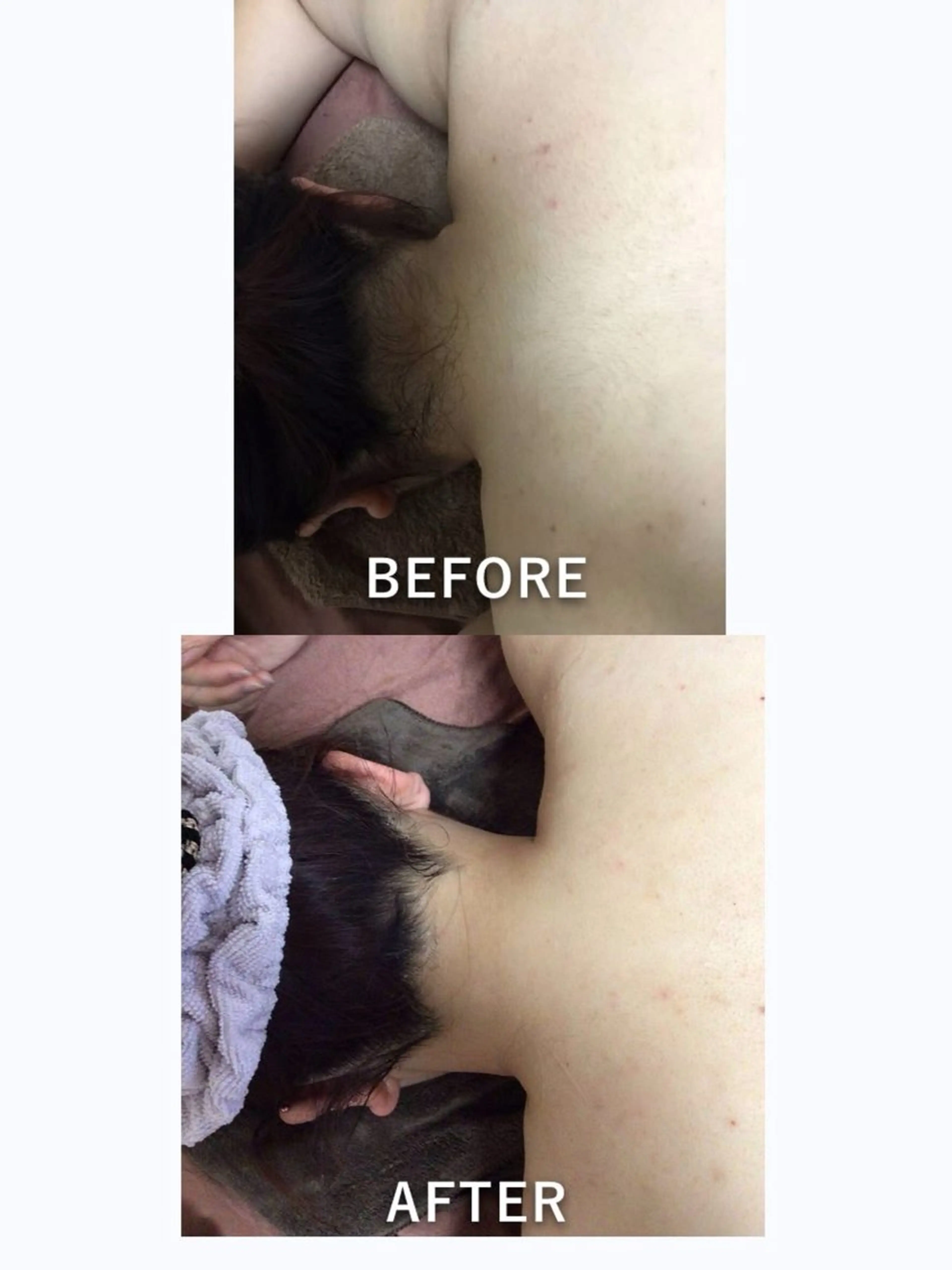 脱毛 仲澤 千春のその他イメージ