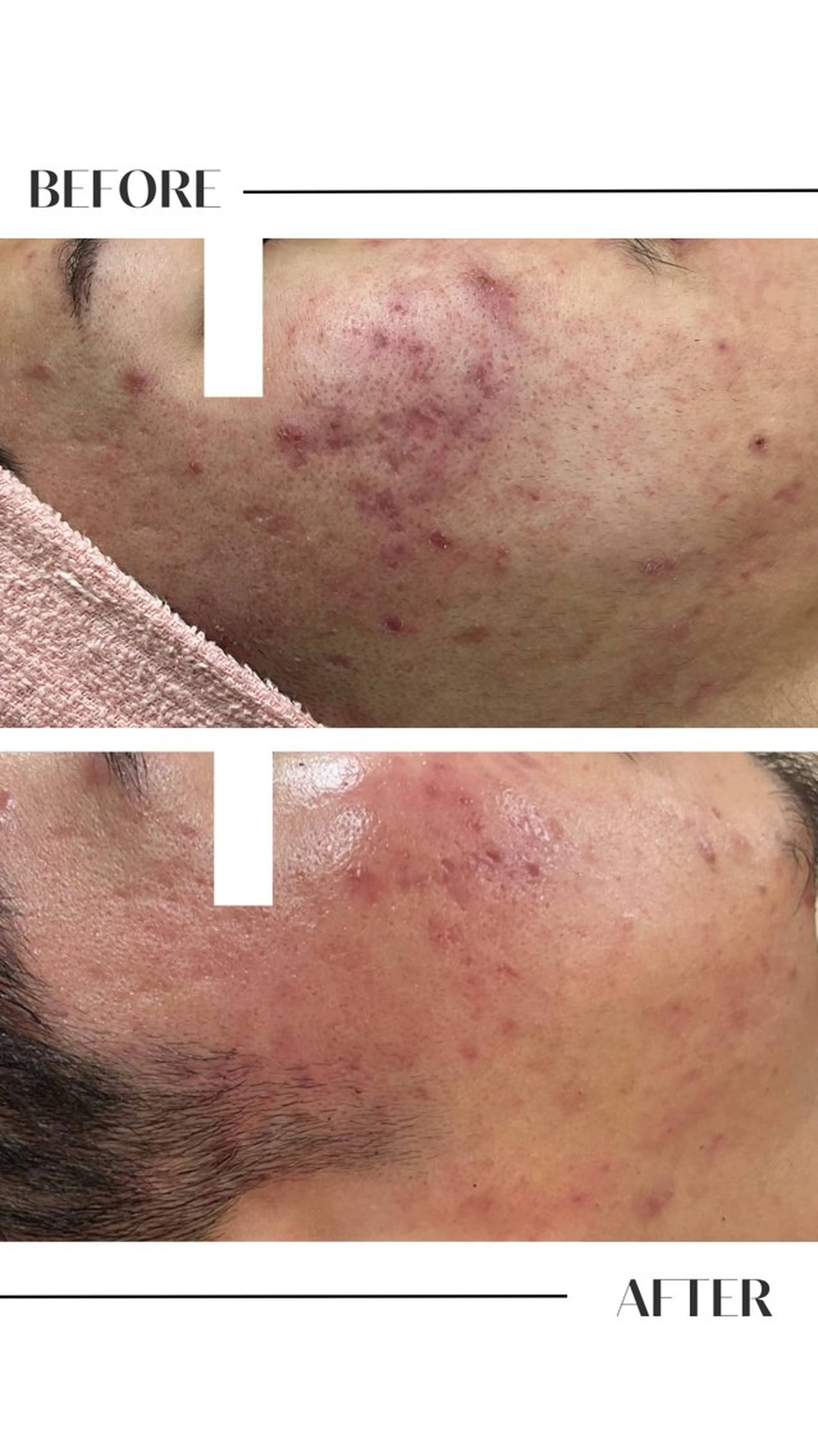 エステ フェイシャル/脱毛 ジョアアンジェ竹田のエステ・リラクイメージ