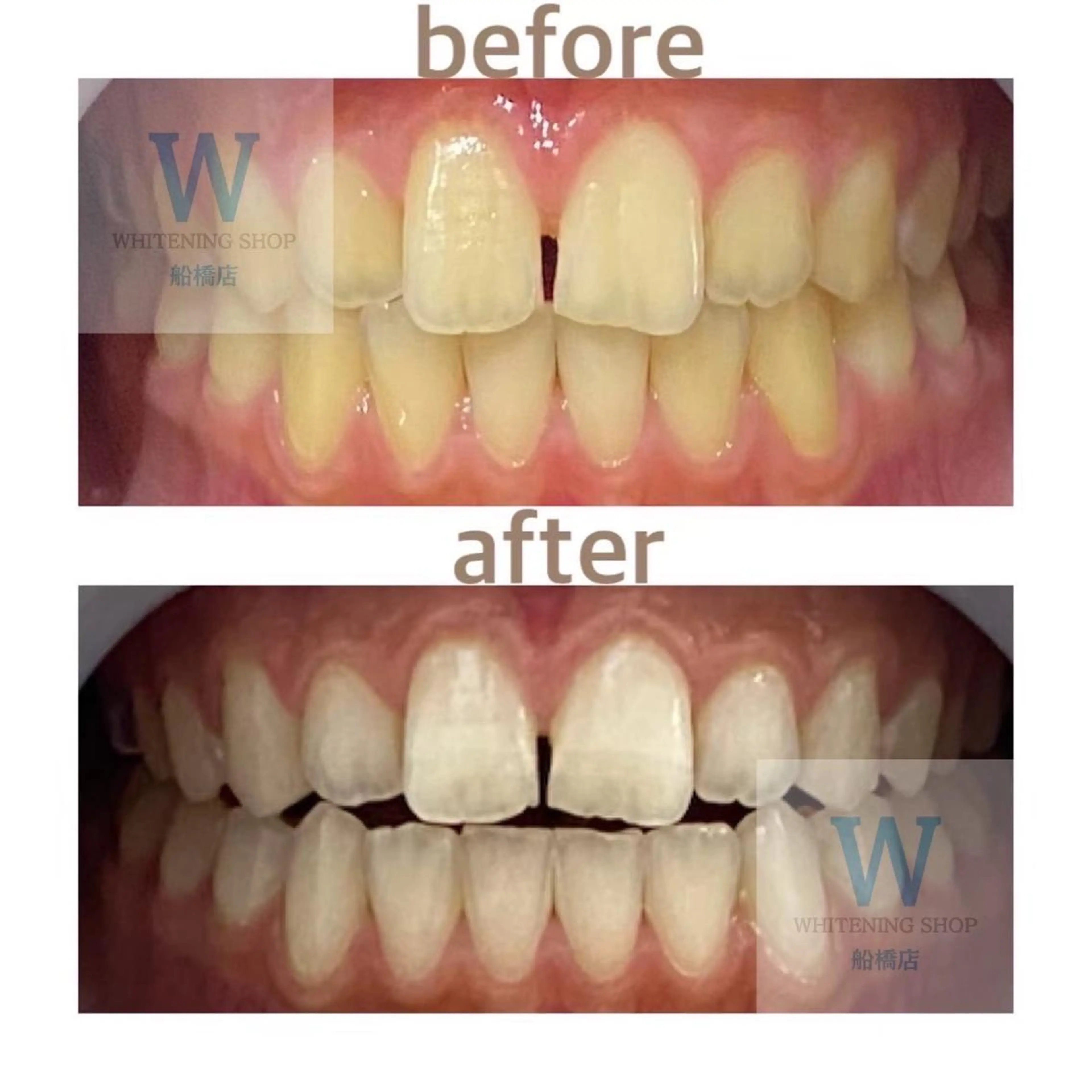 ホワイトニング ショップ船橋2号店のエステ・リラクイメージ