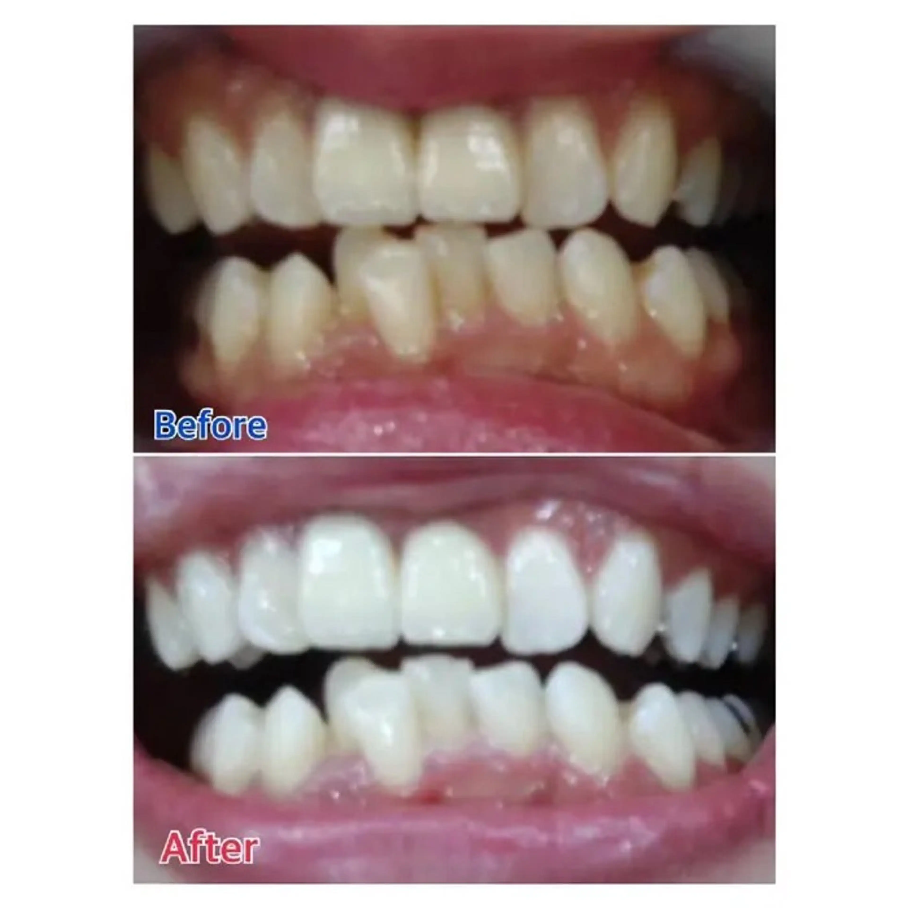 Ｍ渋谷 ホワイトニングのエステ・リラクイメージ