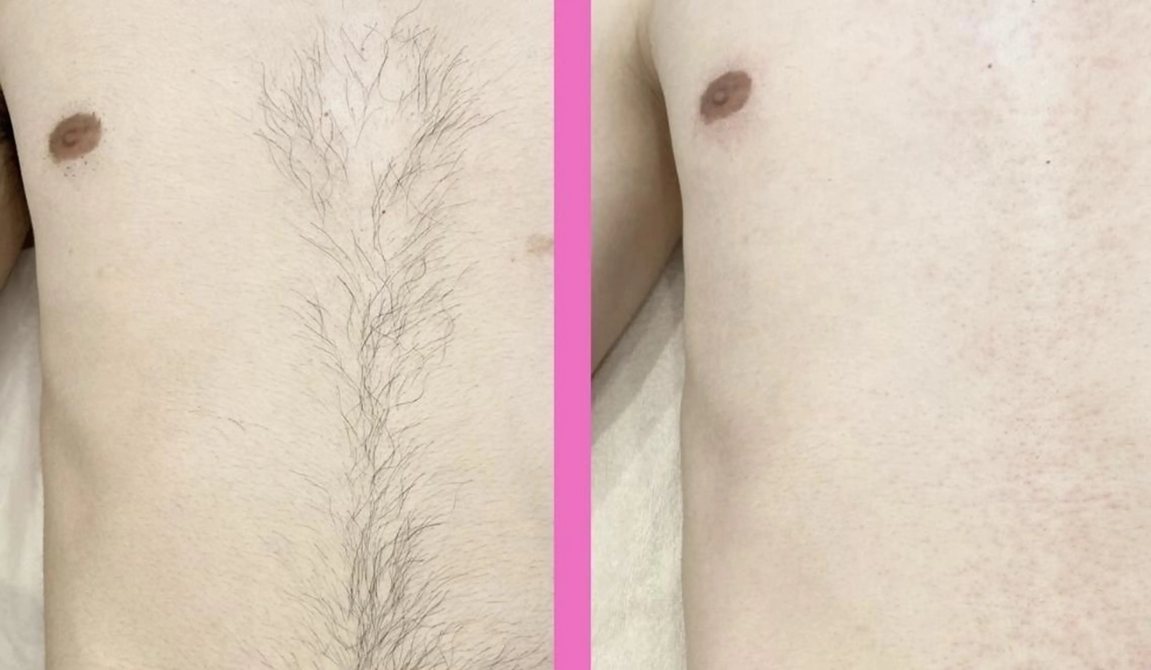 【天神・大名】脱毛/ ハーブ植松७९०のエステ・リラクイメージ