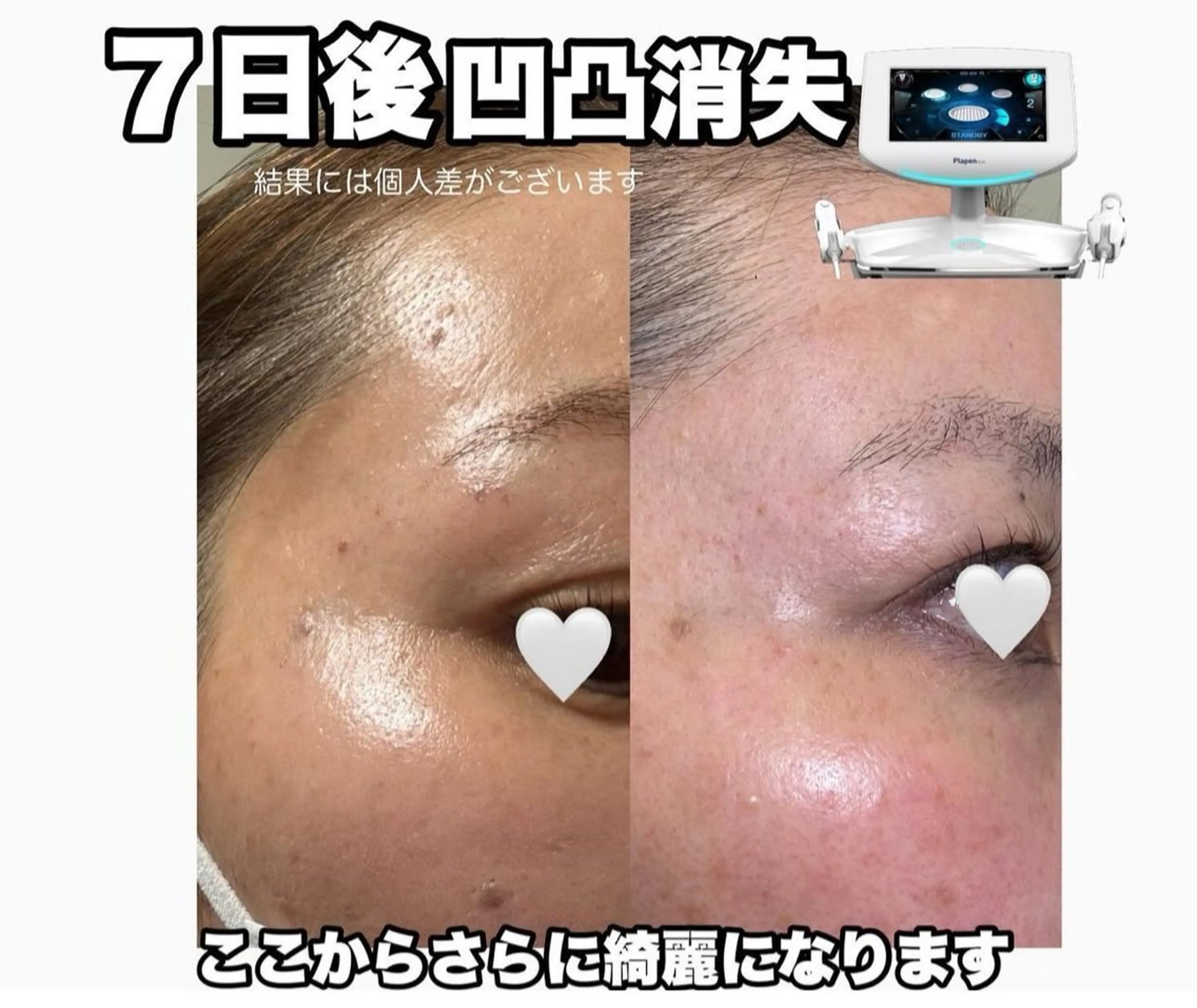 エステ Lumiere despoir所属・Lumiere despoirのエステ・リラクイメージ