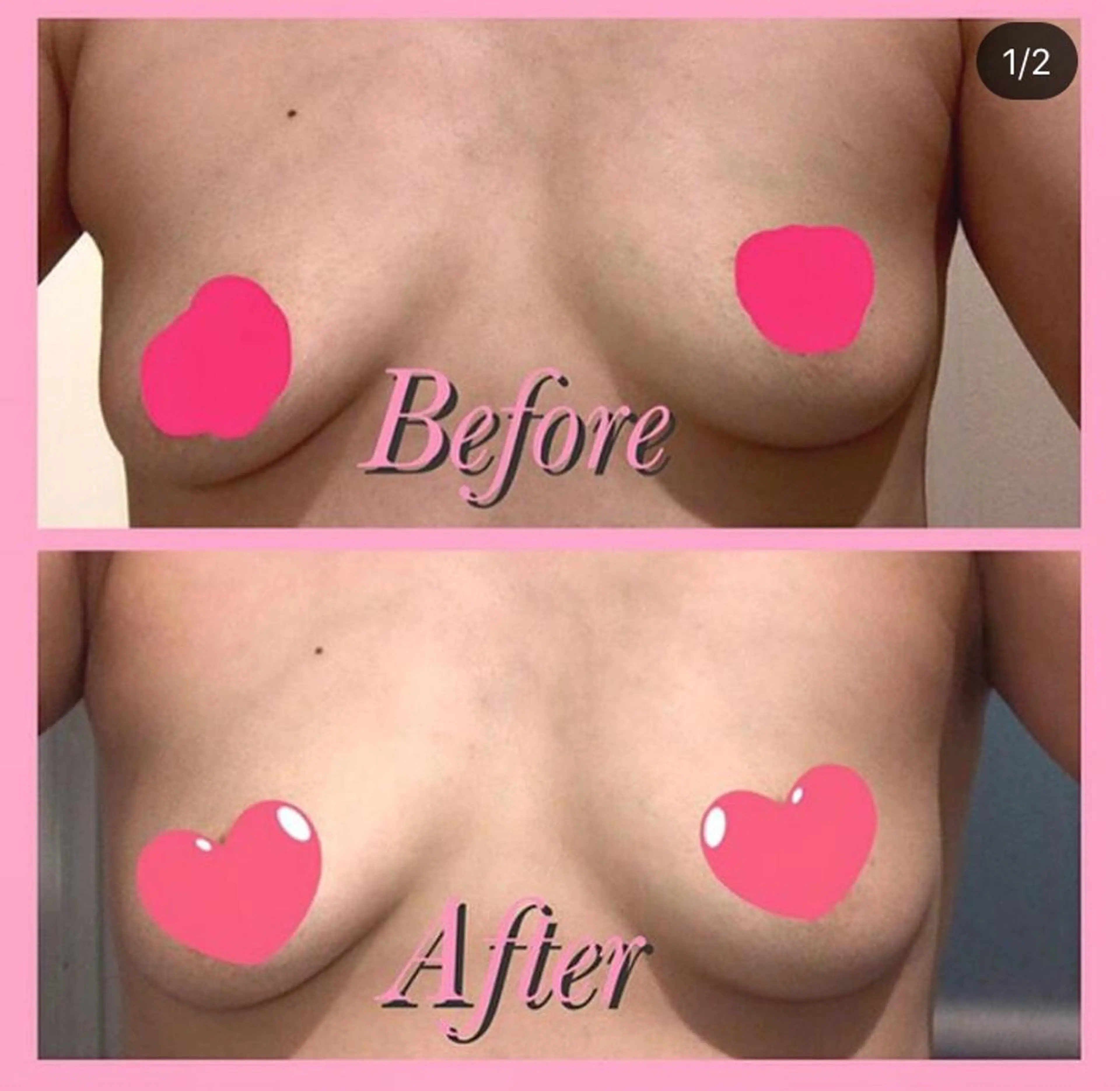 バストアップサロン エミルカのその他イメージ