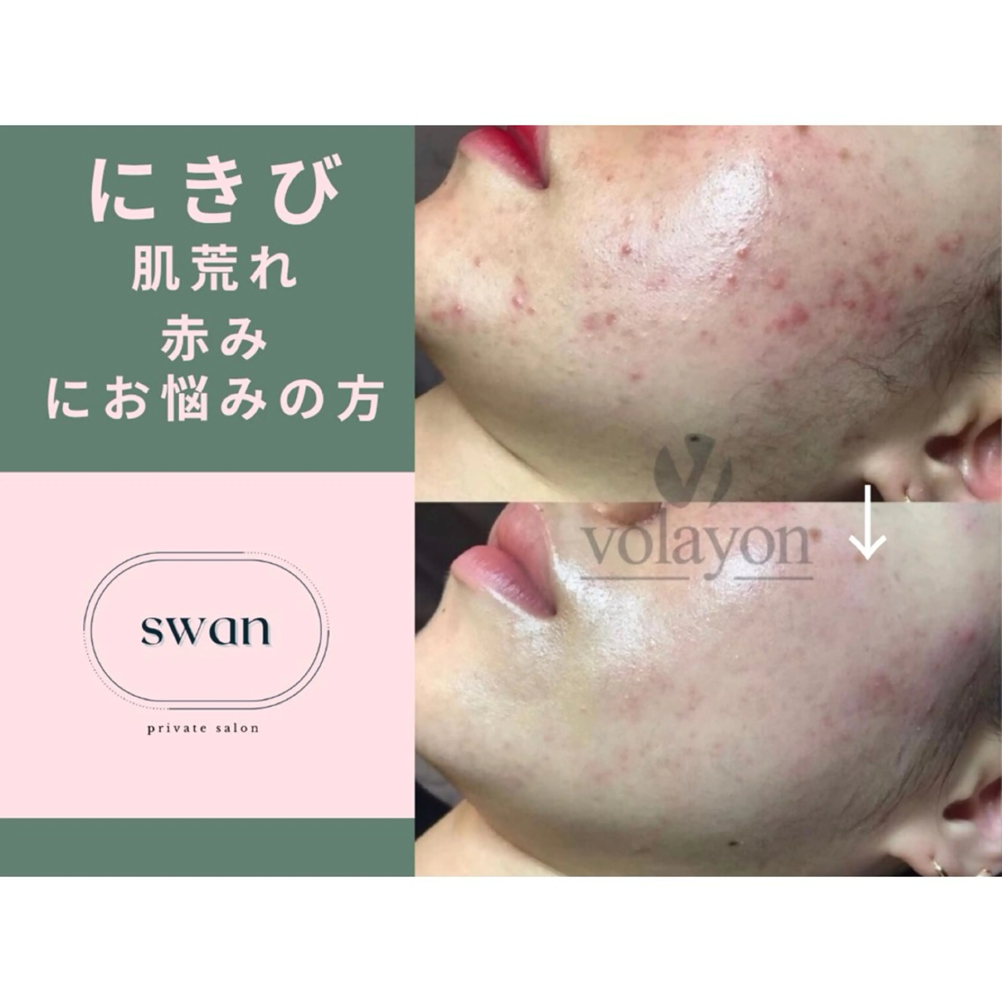 swan(スワン) 韓国肌管理 南堀江のエステ・リラクイメージ