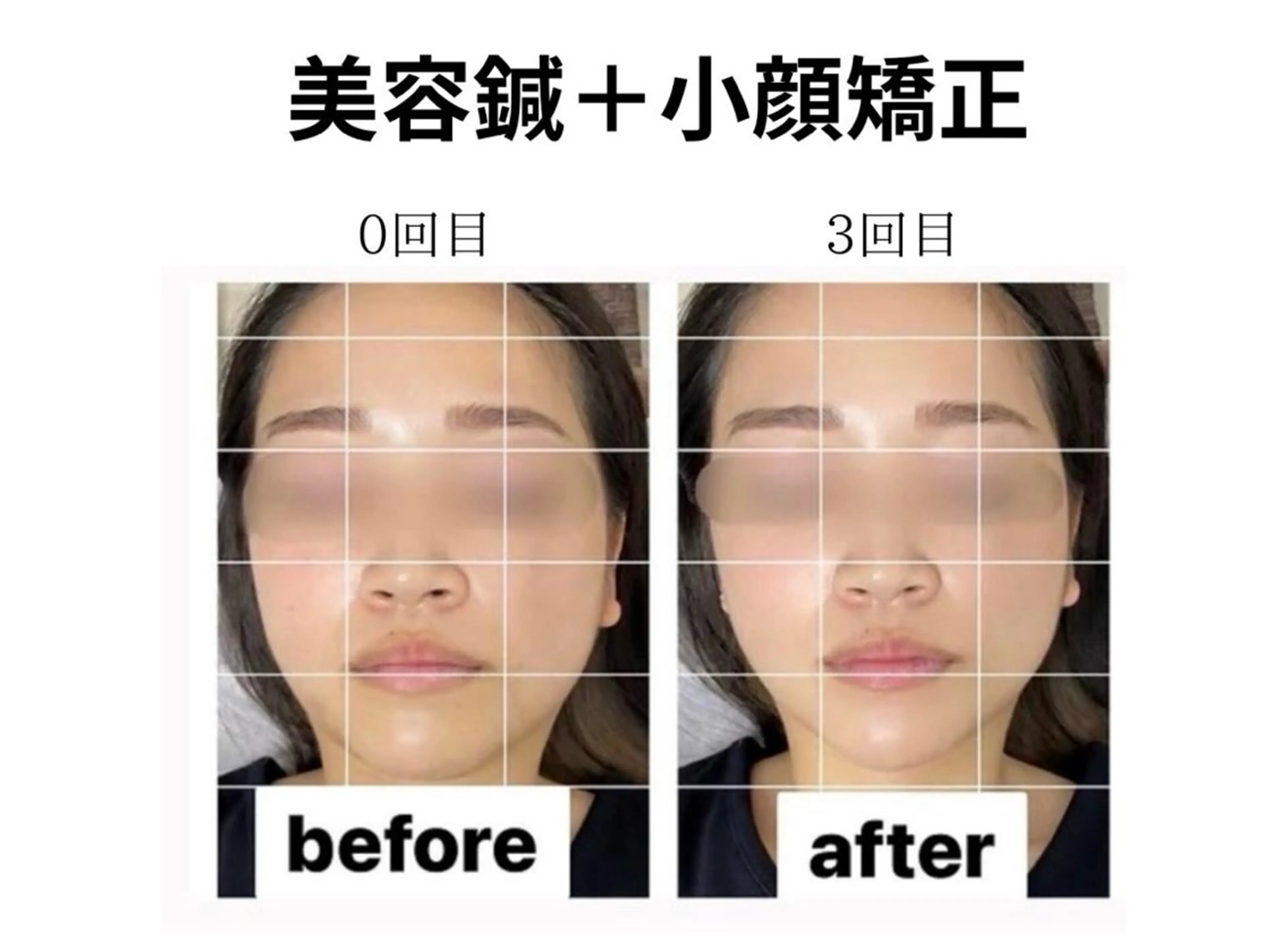 Mr.&Ms.脱毛/ ピーリング/RINAのエステ・リラクイメージ