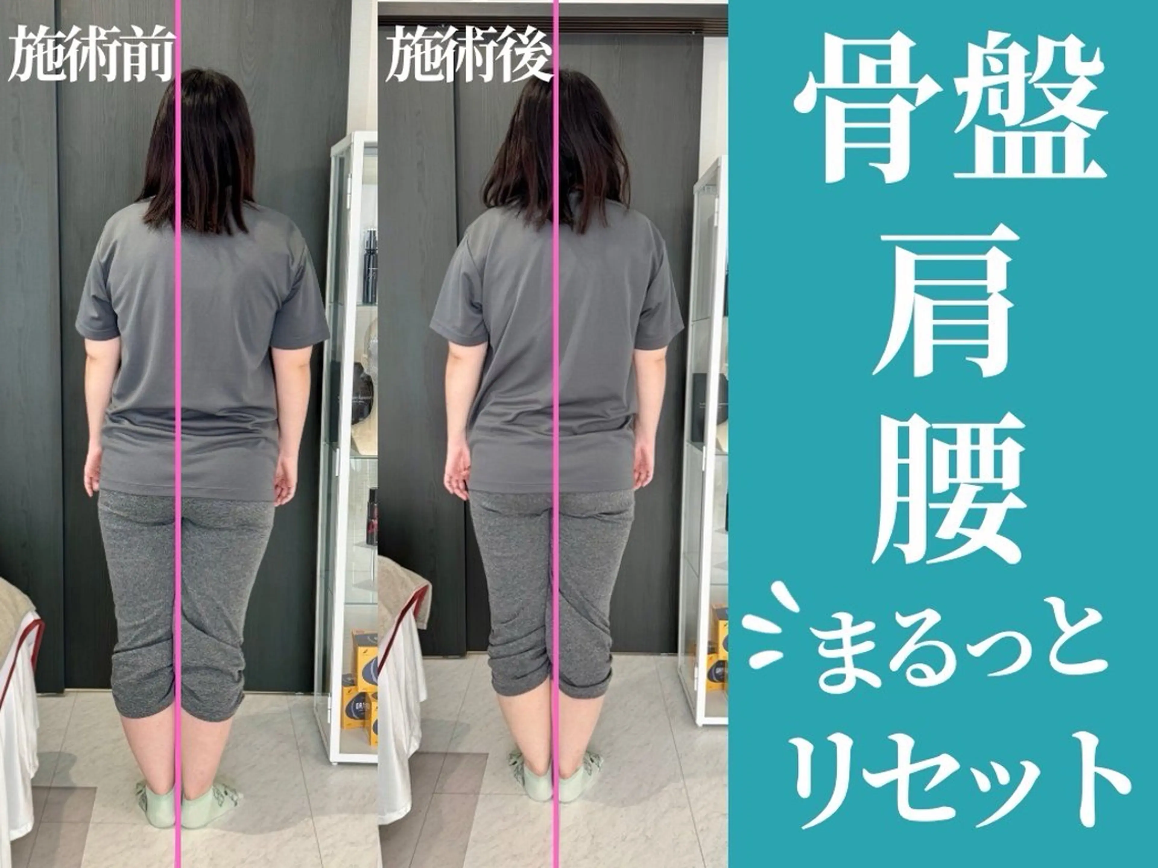 ゲリラ割引★ 【ママ人気】抱っこ・授乳でつらい首肩腰をまとめてケア！初回体験60分¥3,980の写真